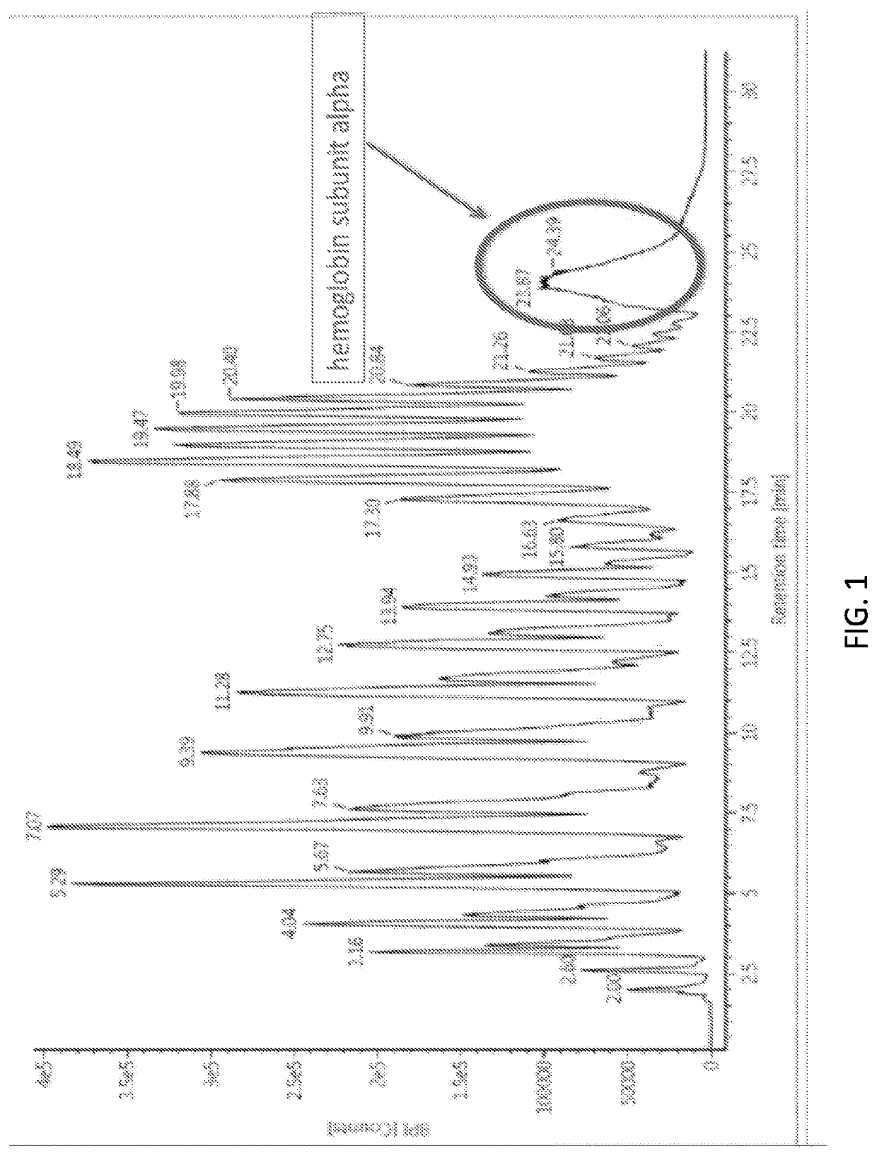 Selection biomarkers for patient stratification in bodily fluids and applying precision medicine through novel diagnostic biomarkers