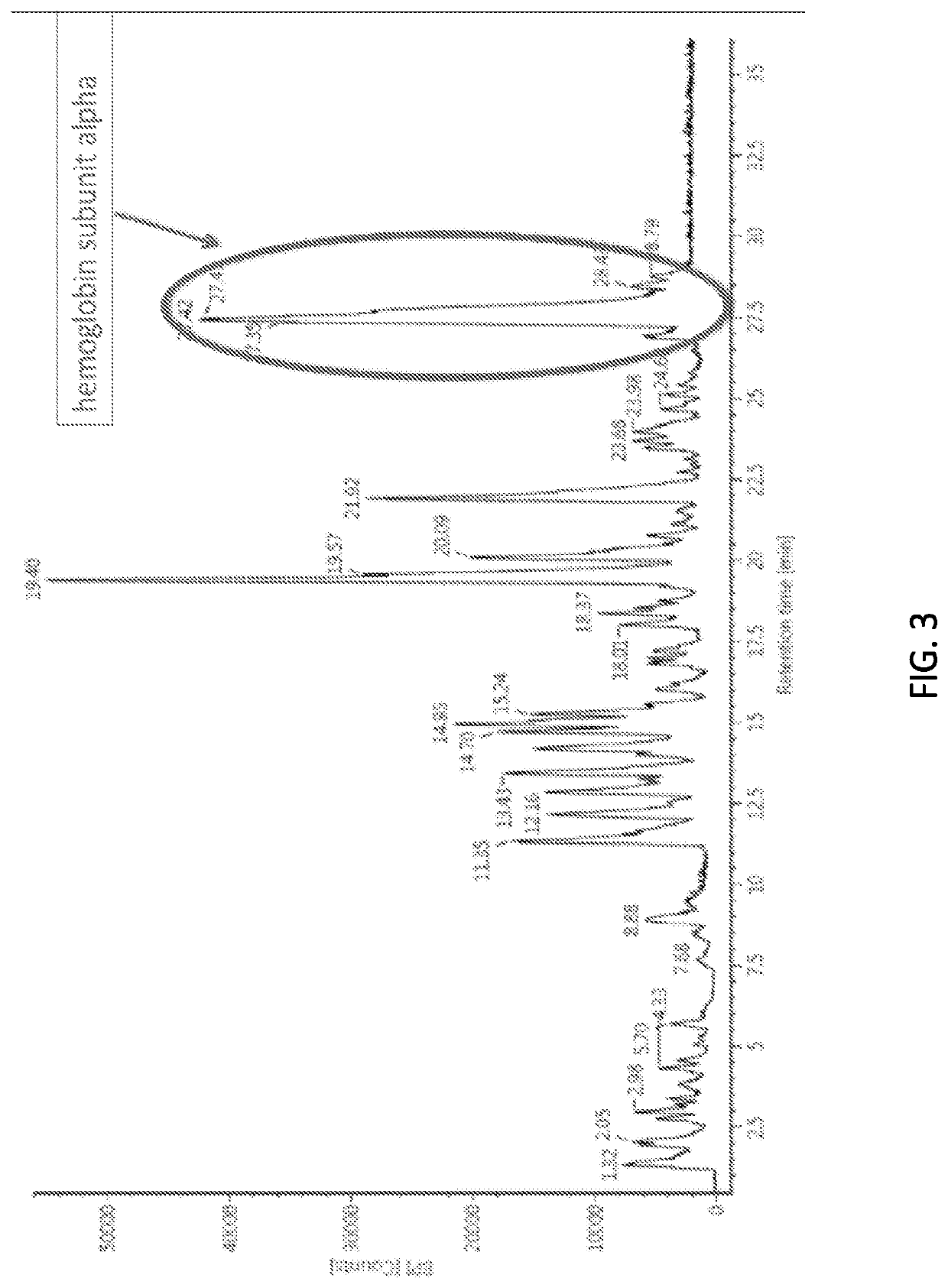 Selection biomarkers for patient stratification in bodily fluids and applying precision medicine through novel diagnostic biomarkers