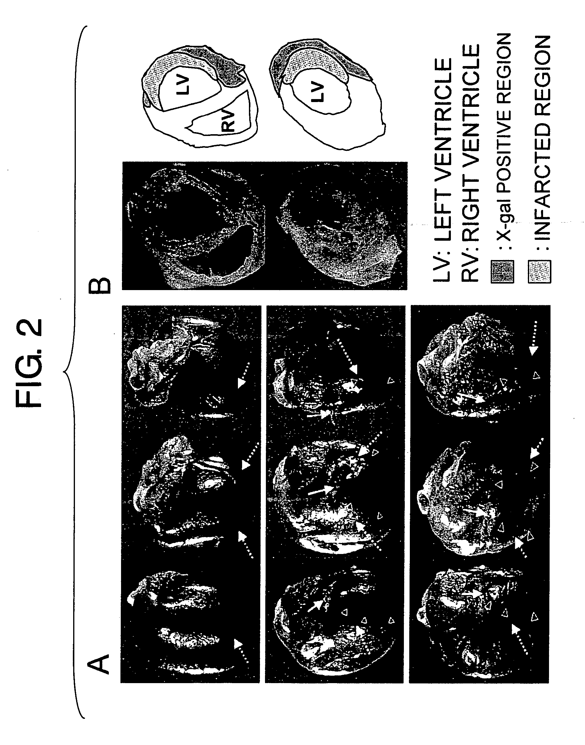 Method for treating ischemic diseases