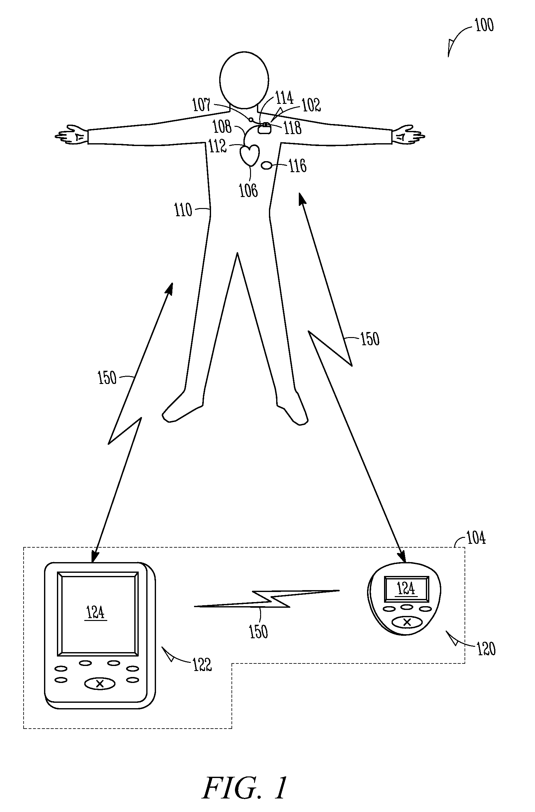 Monitoring of chronobiological rhythms for disease and drug management using one or more implantable device