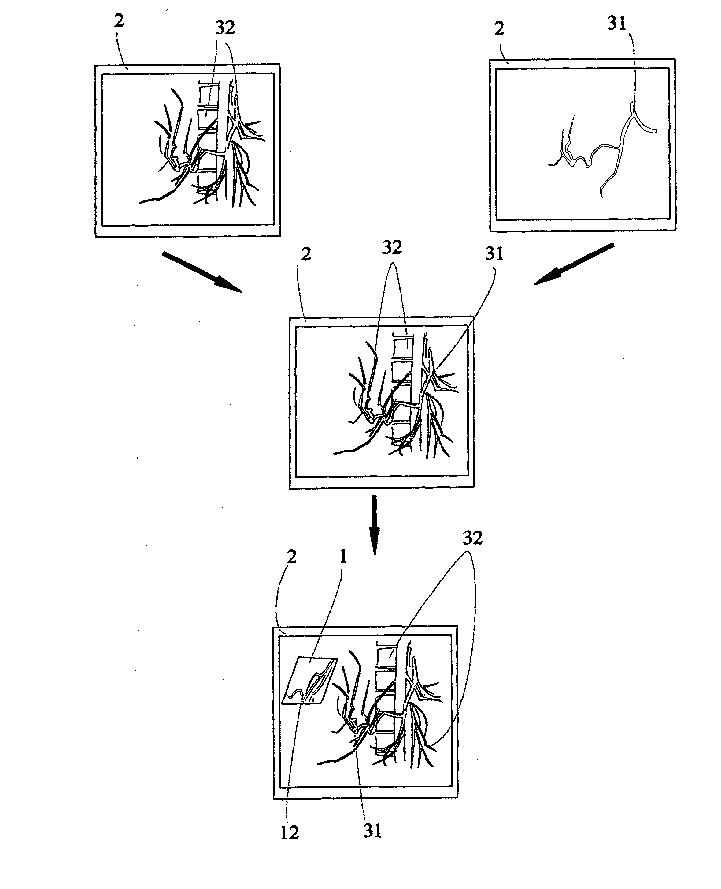 Virtual Penetrating Mirror Device for Visualizing Virtual Objects in Angiographic Applications