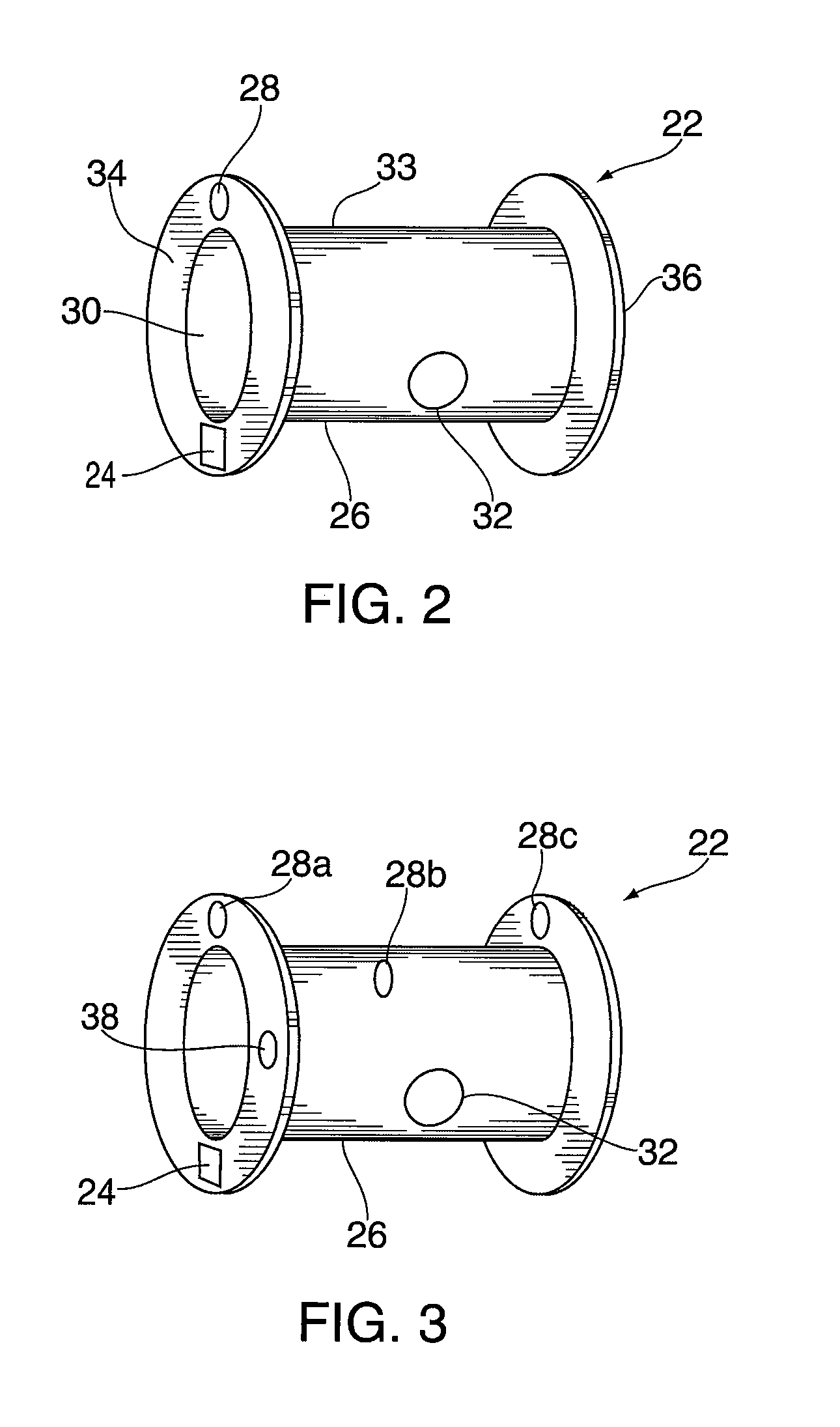 Implantable hearing aid