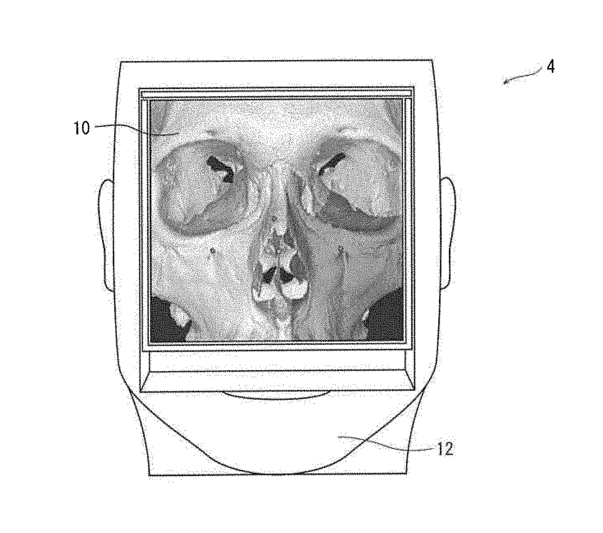 Training apparatus for endoscopic endonasal skull base surgery