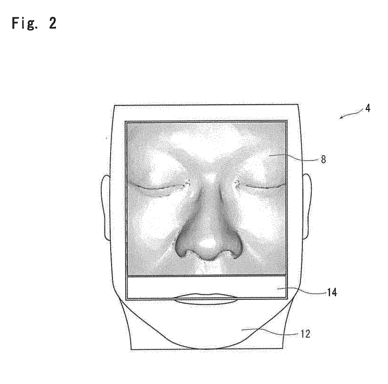 Training apparatus for endoscopic endonasal skull base surgery