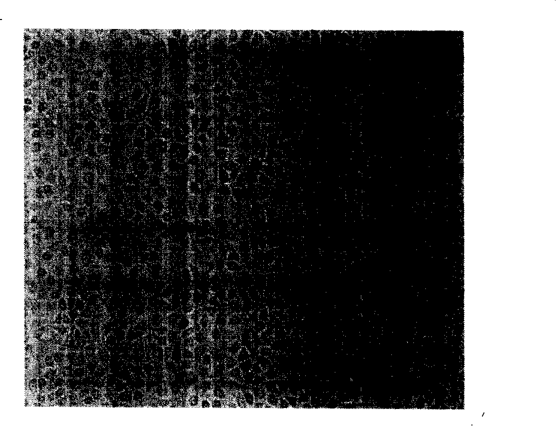 Human breast cancer cell line SK-3rd and construction method thereof