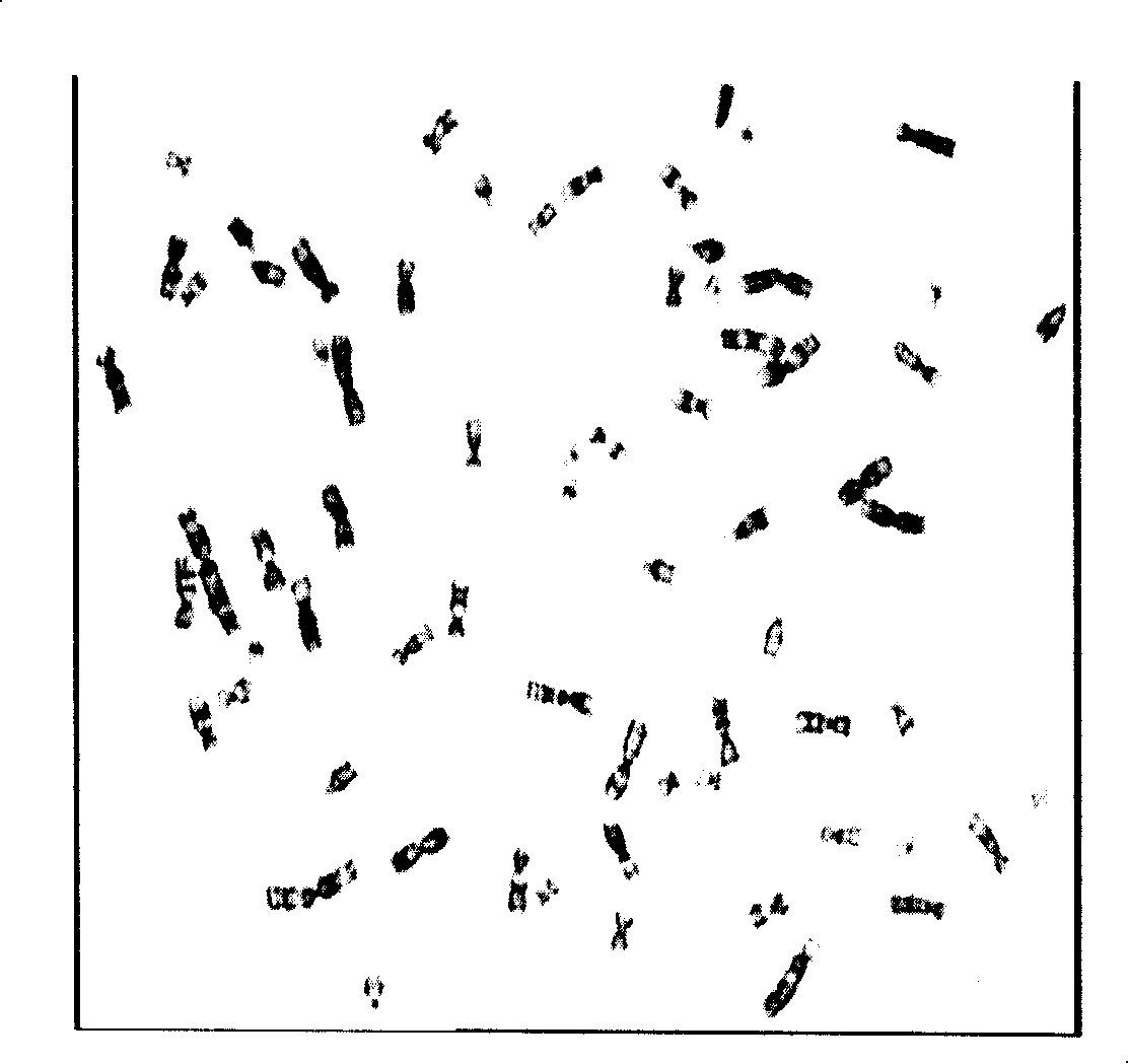 Human breast cancer cell line SK-3rd and construction method thereof