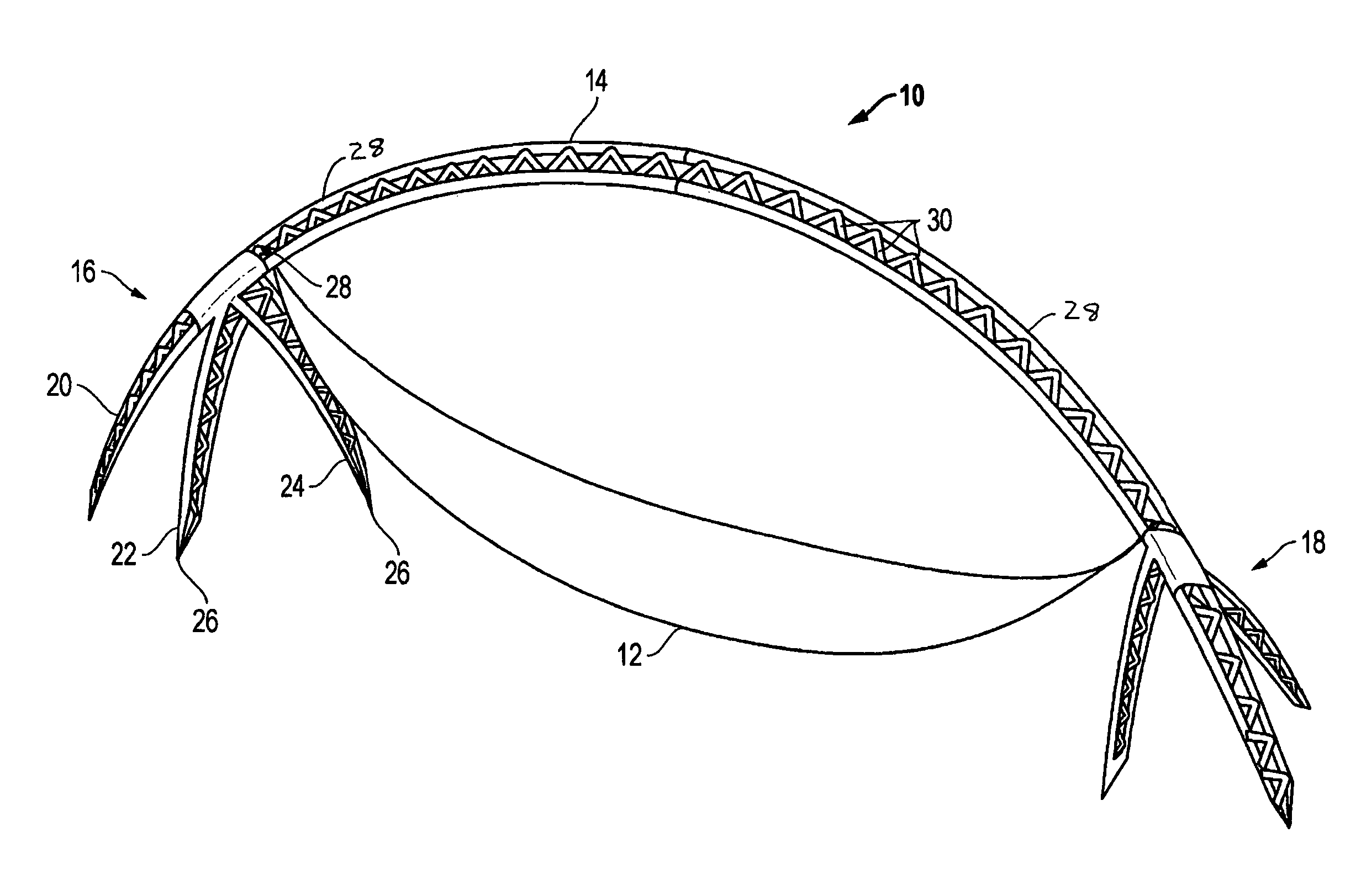 Hammock arch