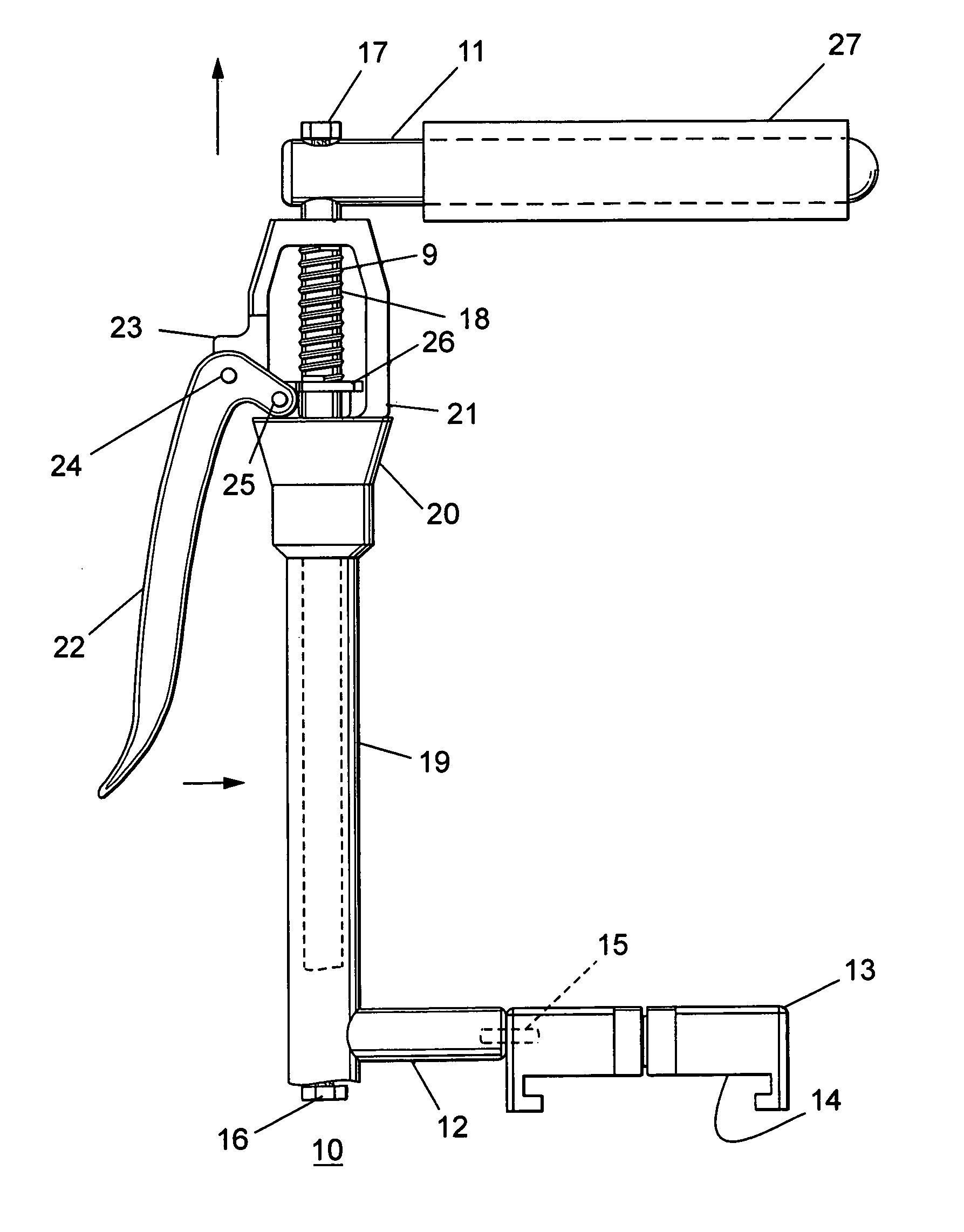 Non-invasive femoral distractor for use in knee surgery