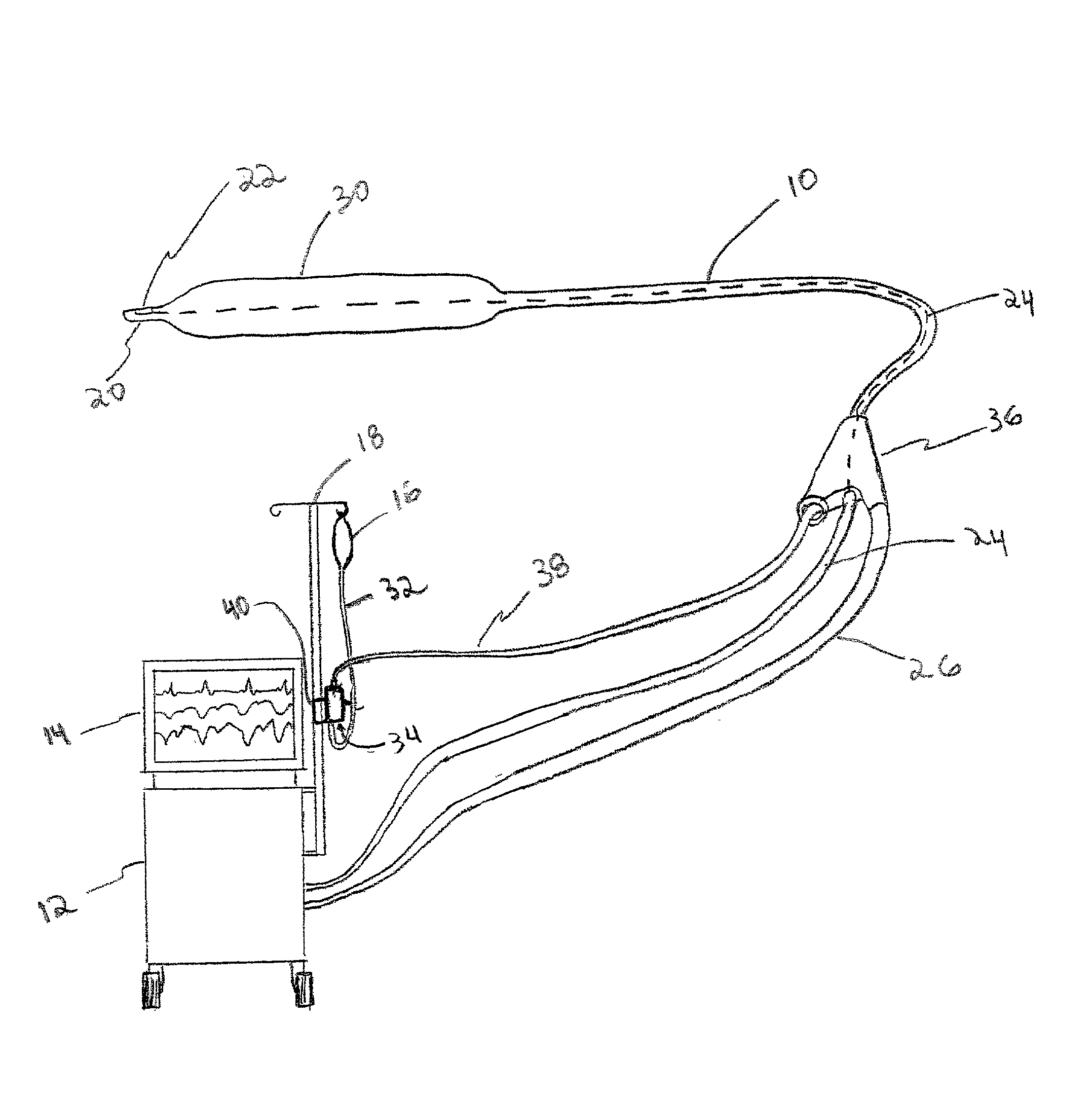 Intra-aortic balloon catheter having a dual sensor pressure sensing system