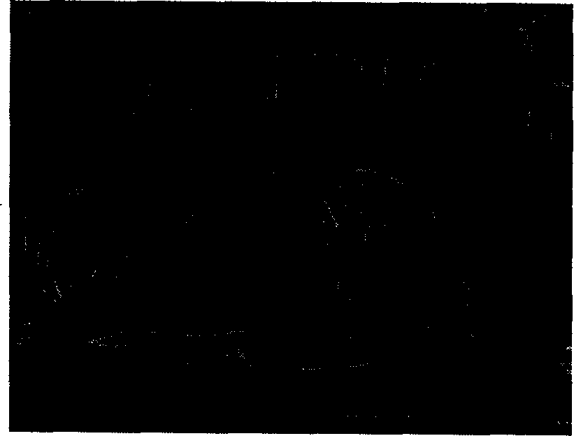 Adaptive residual error frame operation method bused on video image complexity