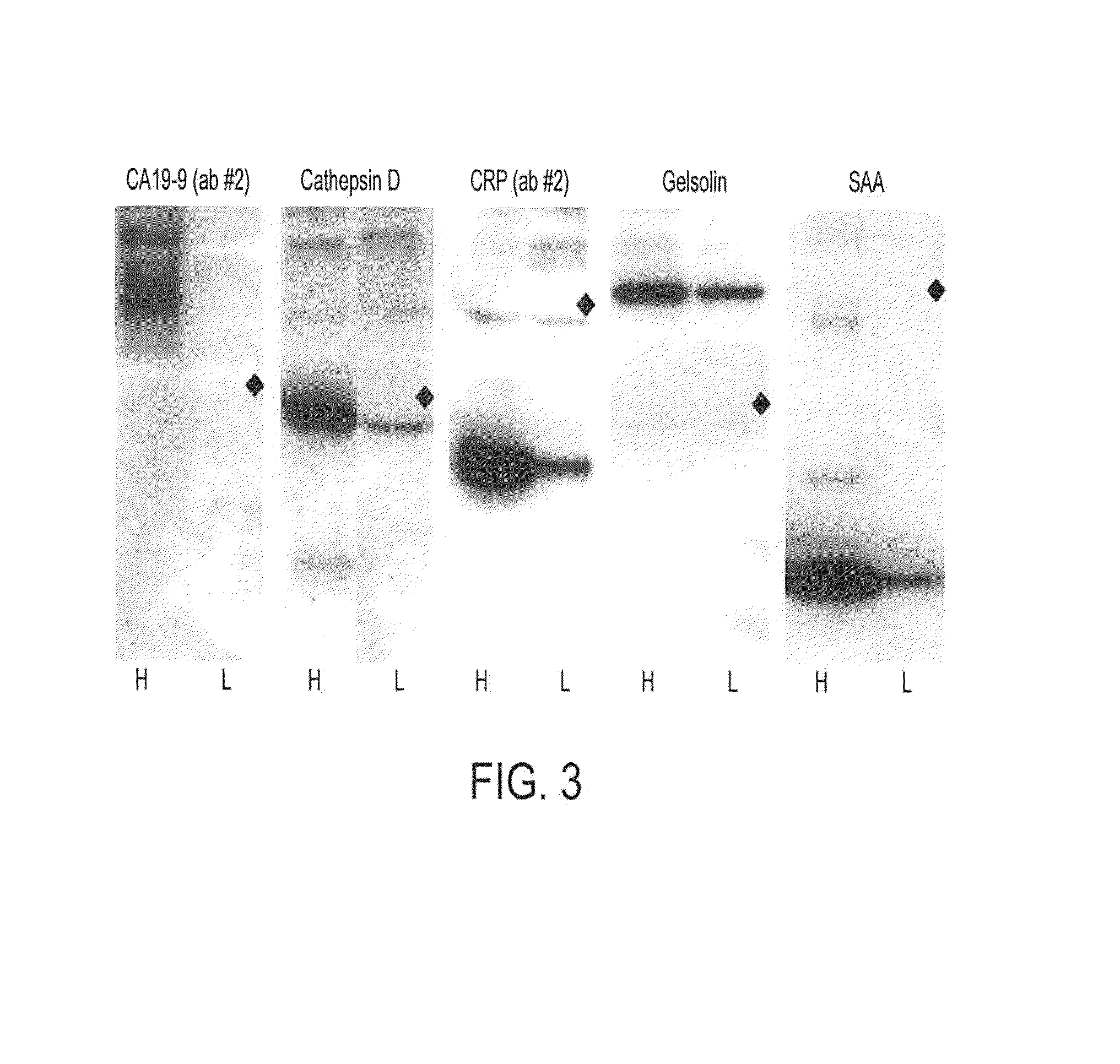 Biomarkers for pancreatic cancer and diagnostic methods