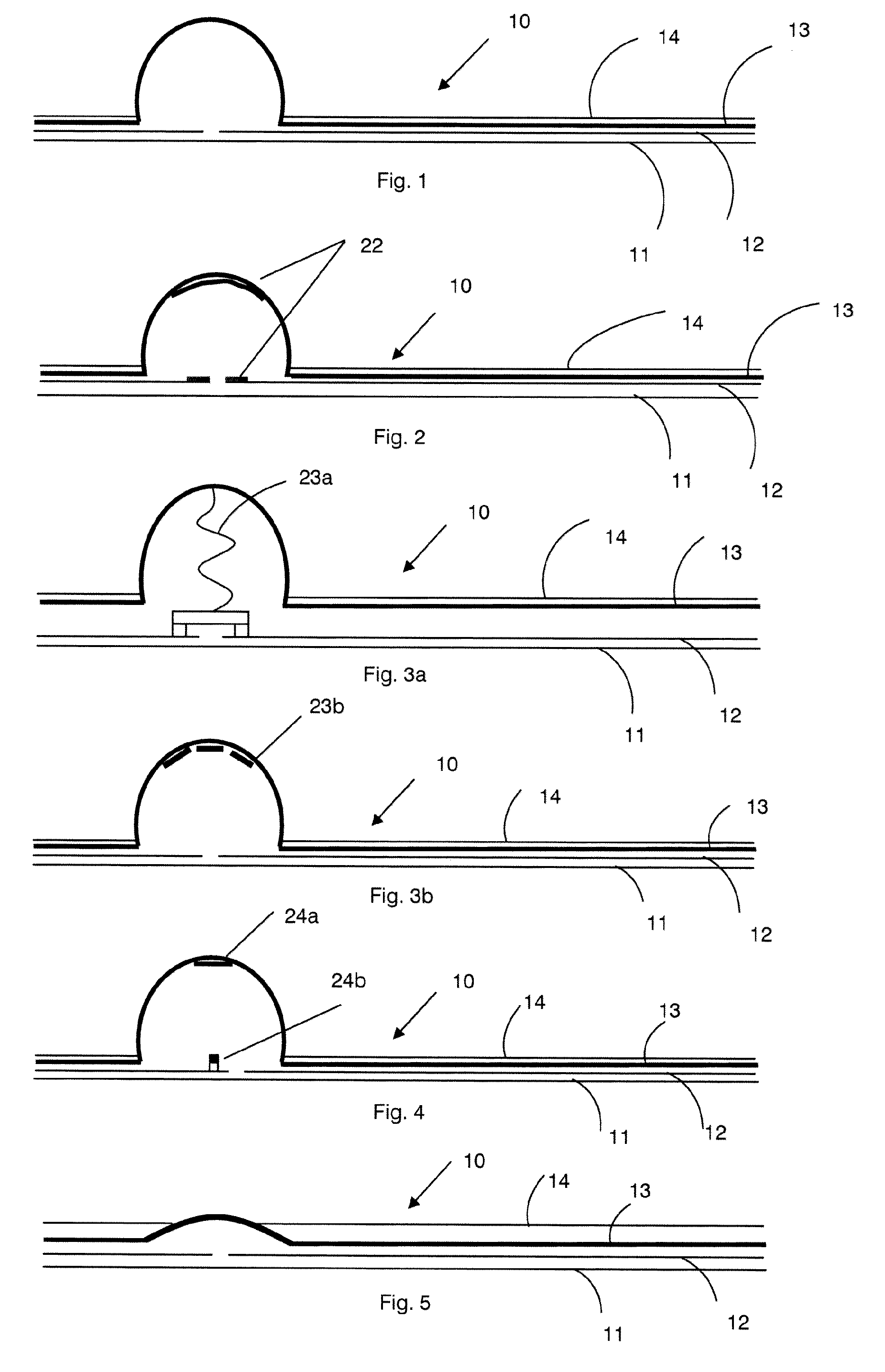 Pressure sensor