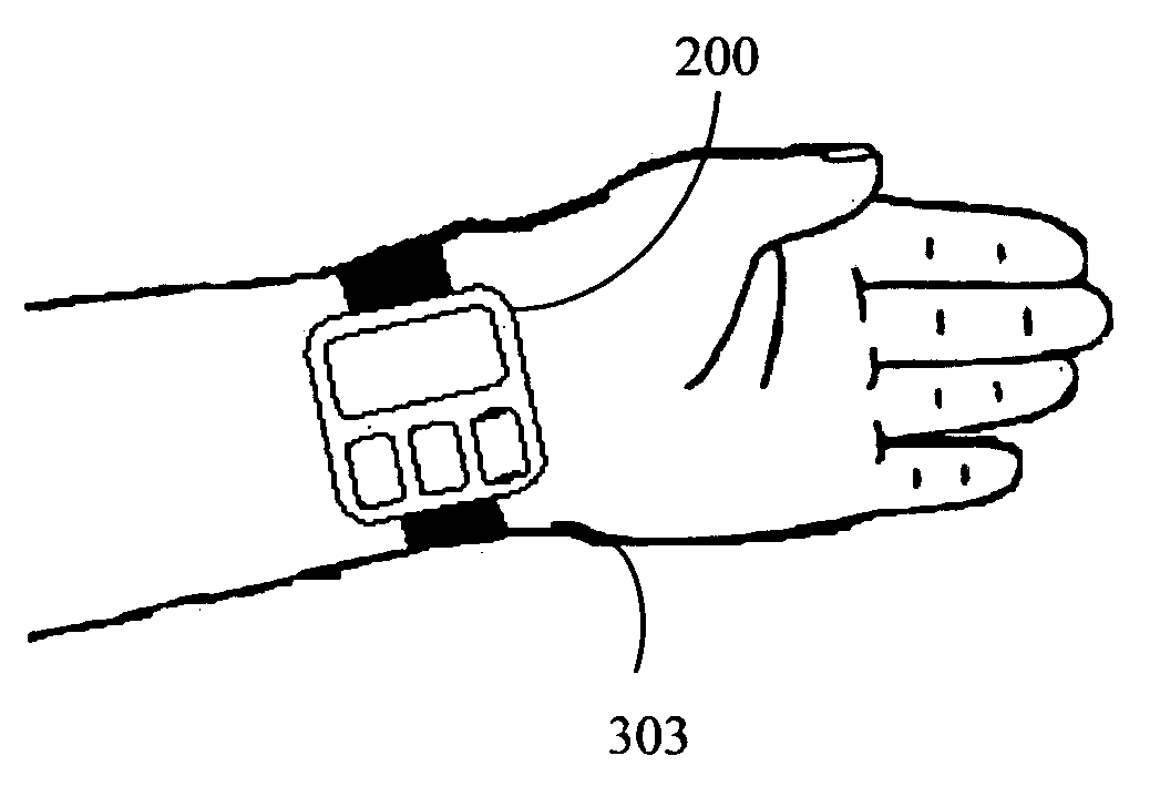 Apparatus and method for alleviating nausea