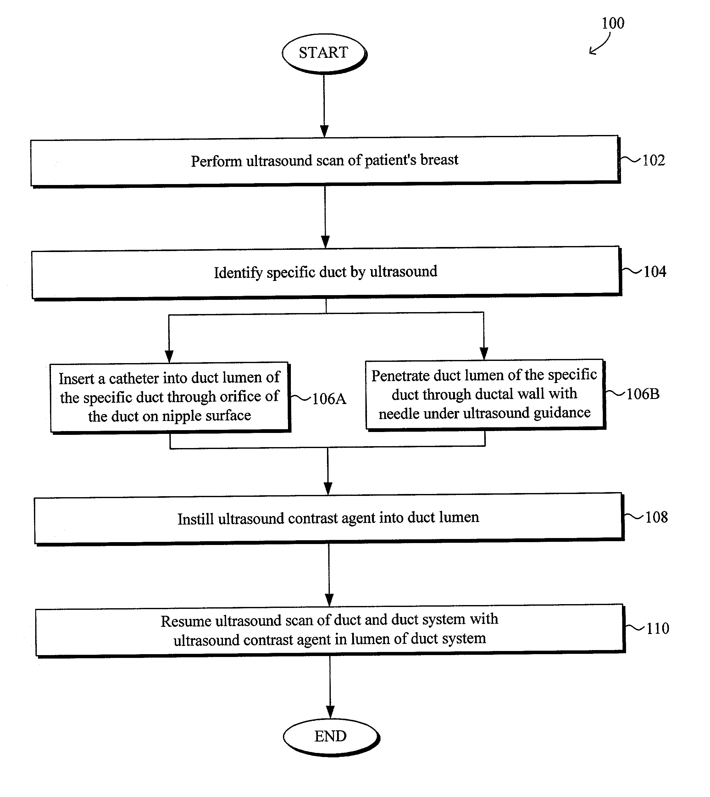 Ultrasound imaging of breast tissue using ultrasound contrast agent