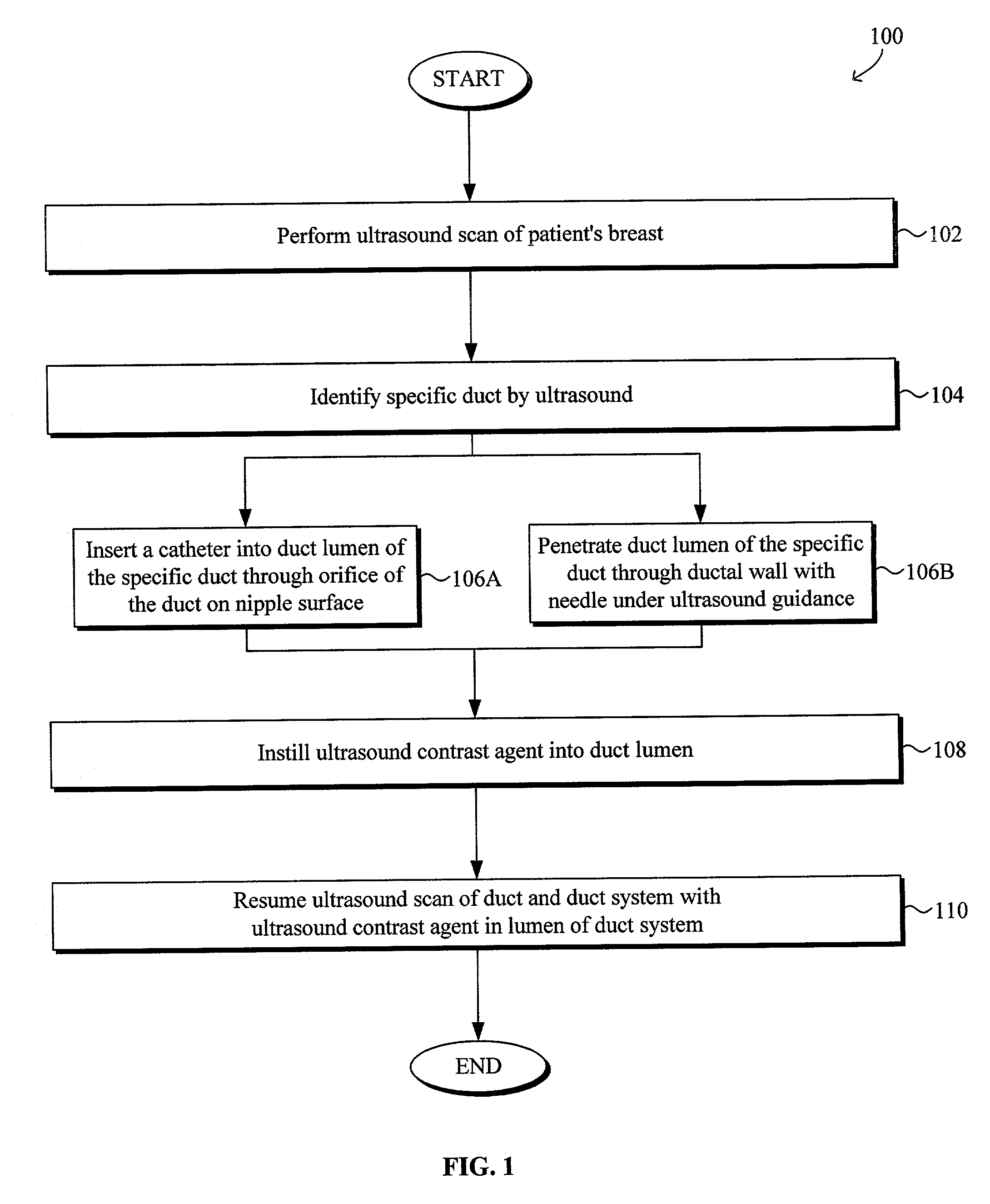 Ultrasound imaging of breast tissue using ultrasound contrast agent