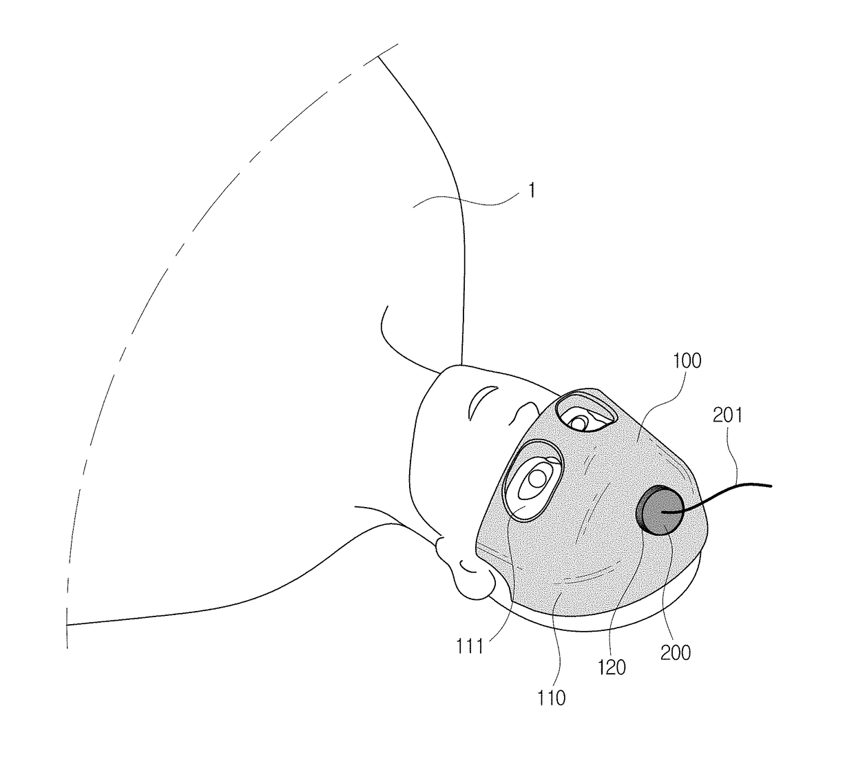 Ultrasonic stimulation device using guide framework