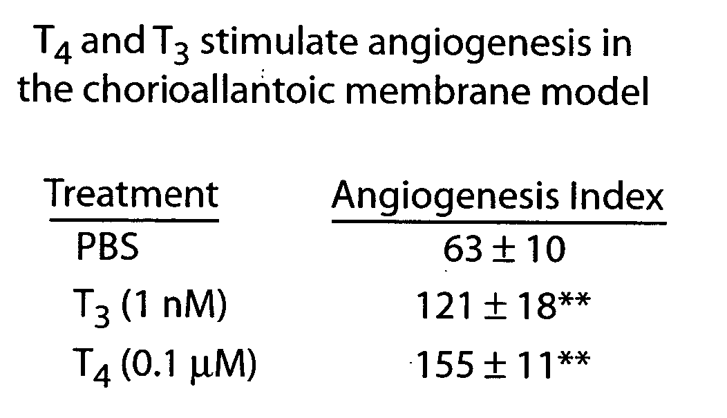 Thyroid hormone analogs and methods of use