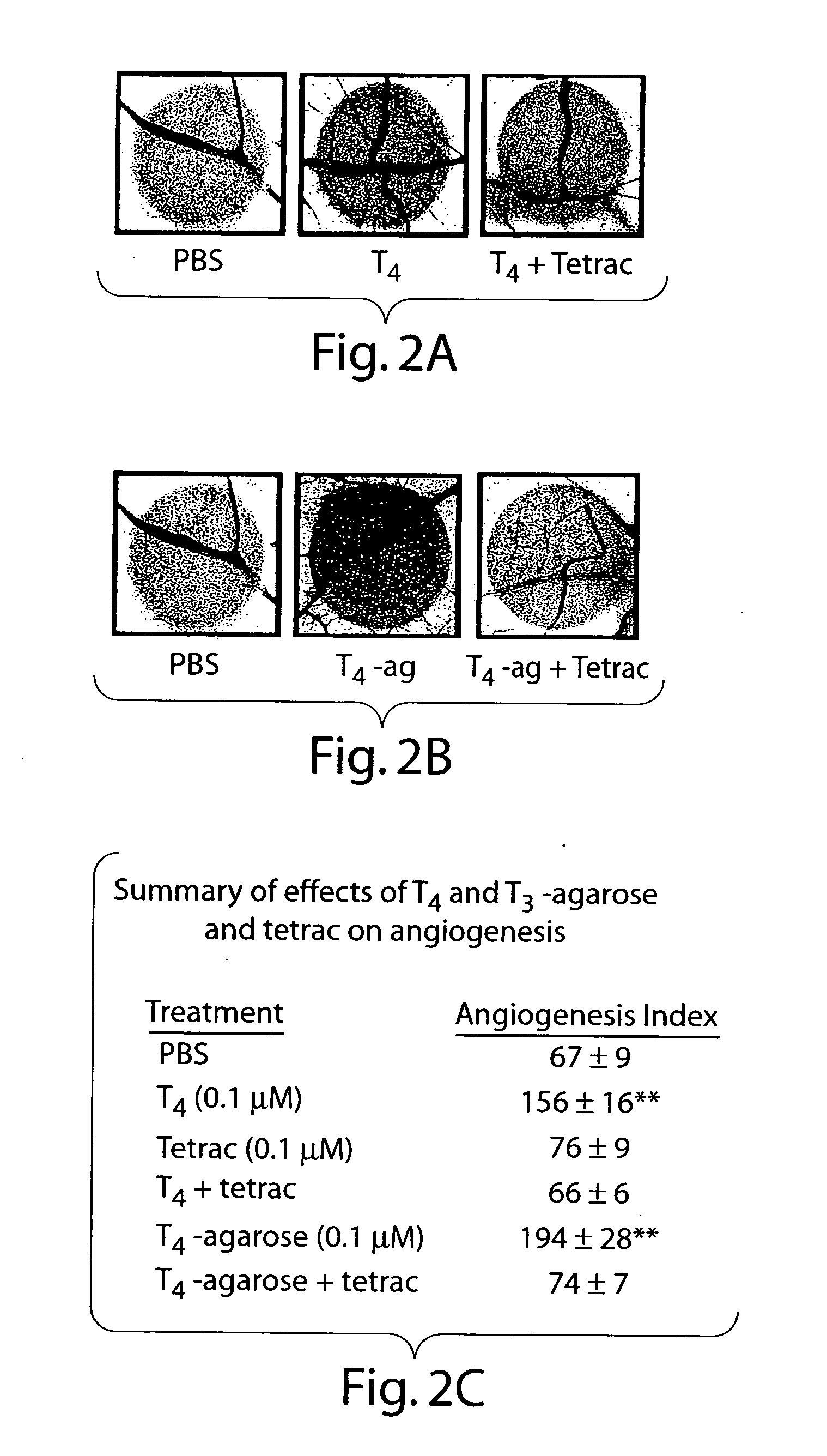 Thyroid hormone analogs and methods of use