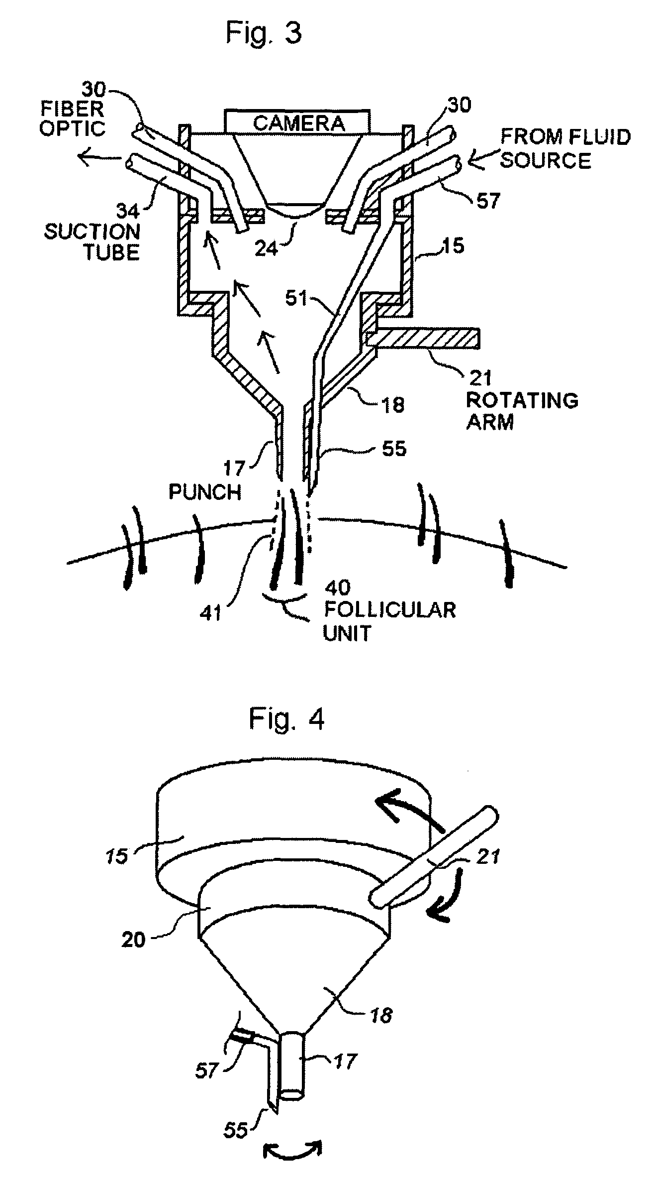 Hair harvesting device and method with localized subsurface dermal fluid insertion