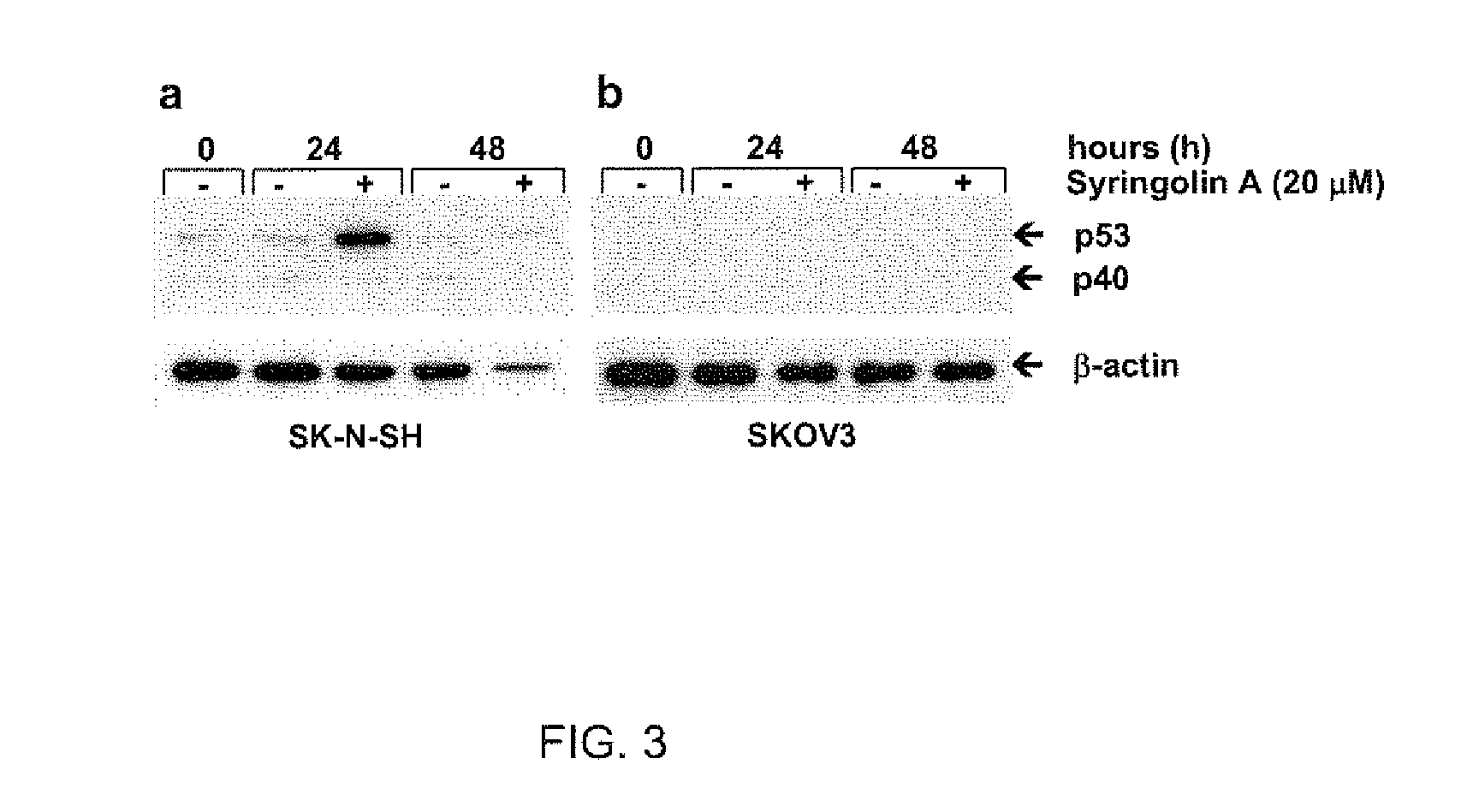 Pharmaceutical compositions for the treatment of conditions responsive to proteasome inhibition