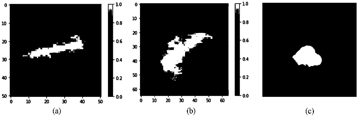 Brain tumor image segmentation algorithm based on improved full-convolution neural network