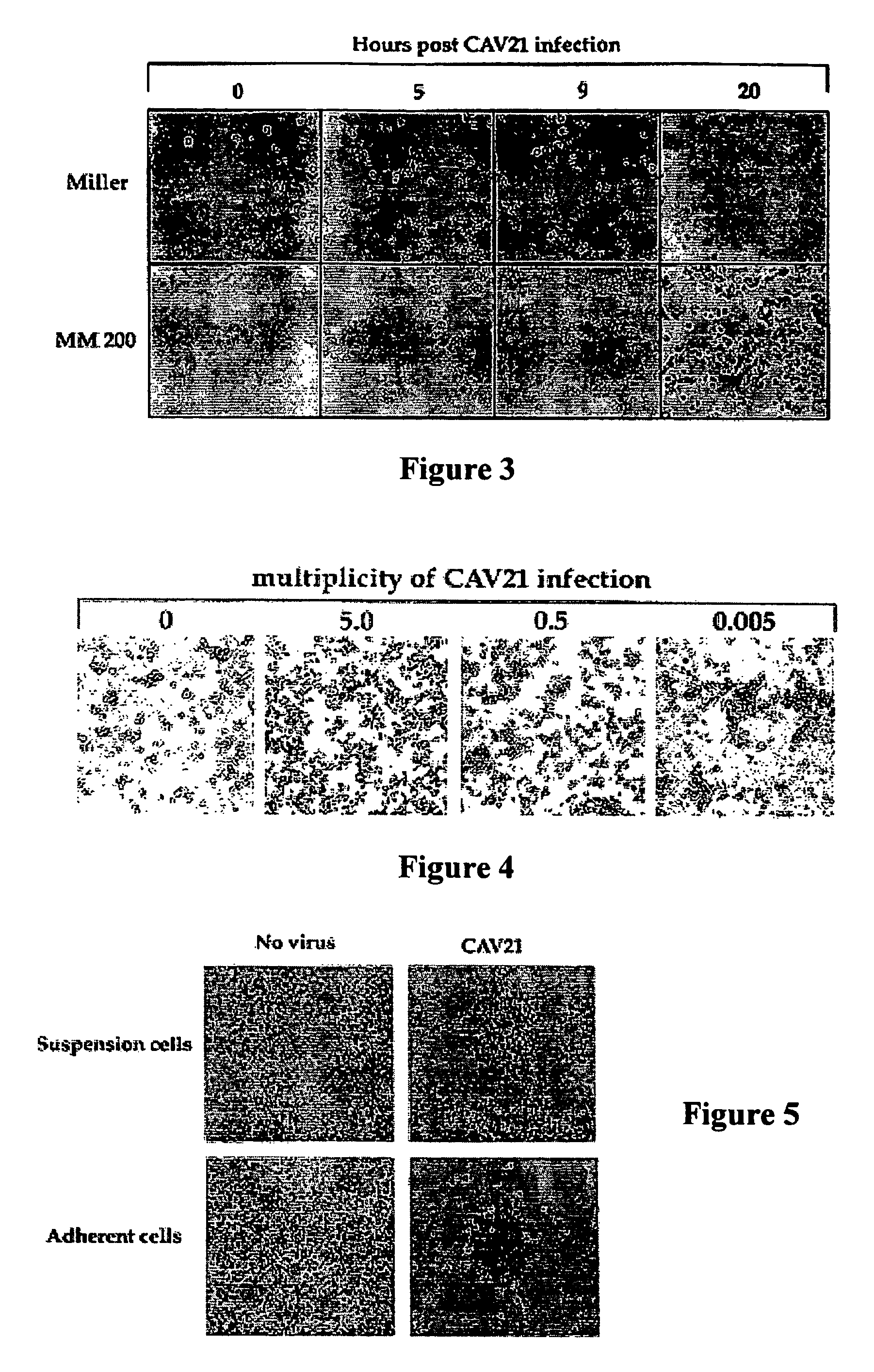 Methods for treating malignancies expressing ICAM-1 using coxsackie a group viruses