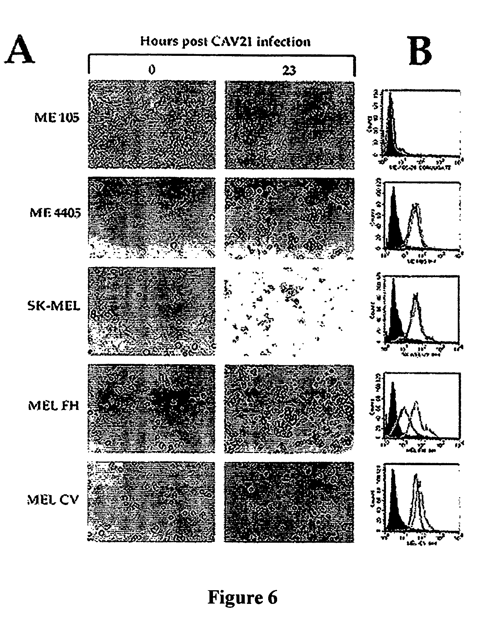 Methods for treating malignancies expressing ICAM-1 using coxsackie a group viruses