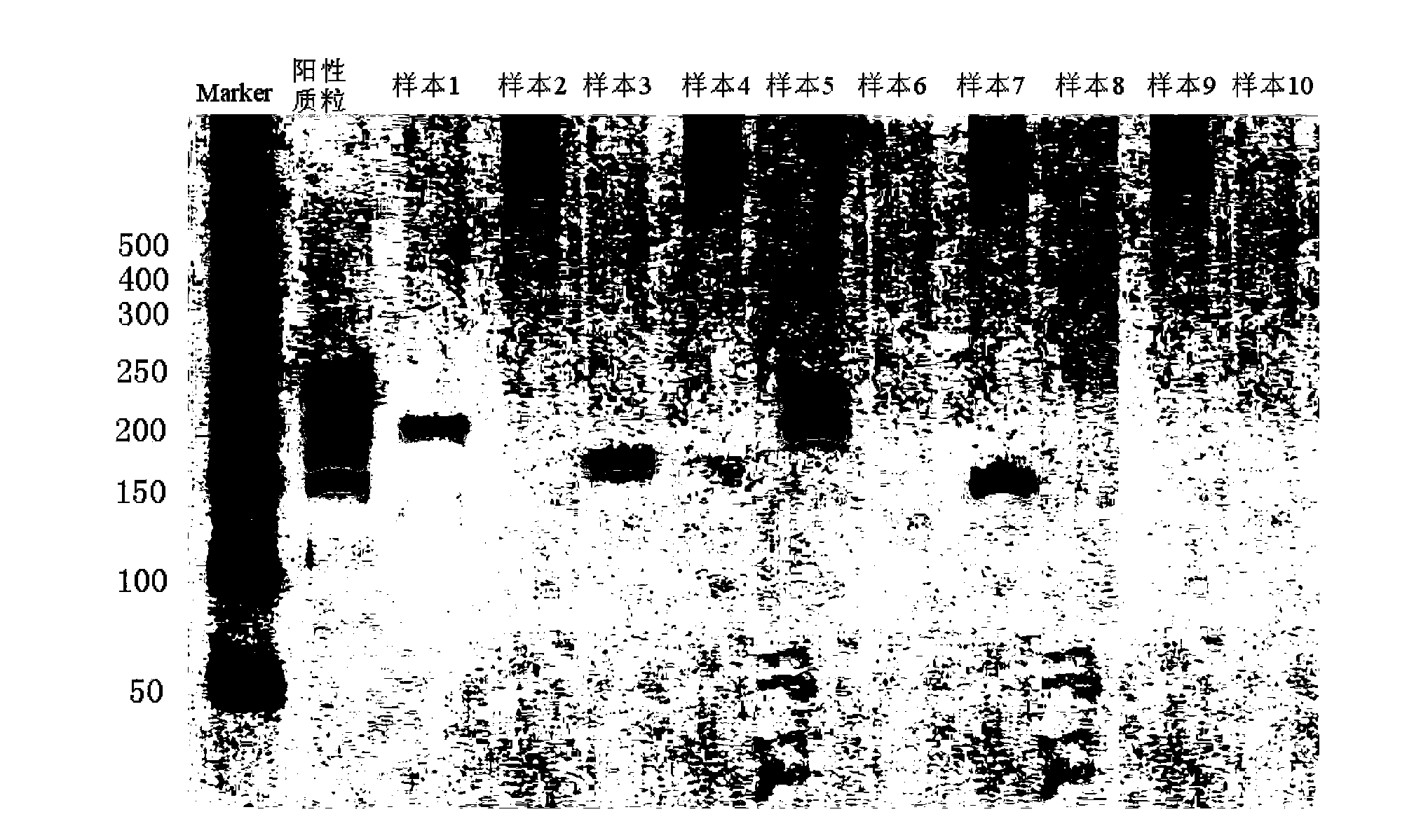 PCR (Polymerase Chain Reaction) primer, kit and liquid phase chip for detecting ALK (Anaplastic Lymphoma Kinase) fusion gene