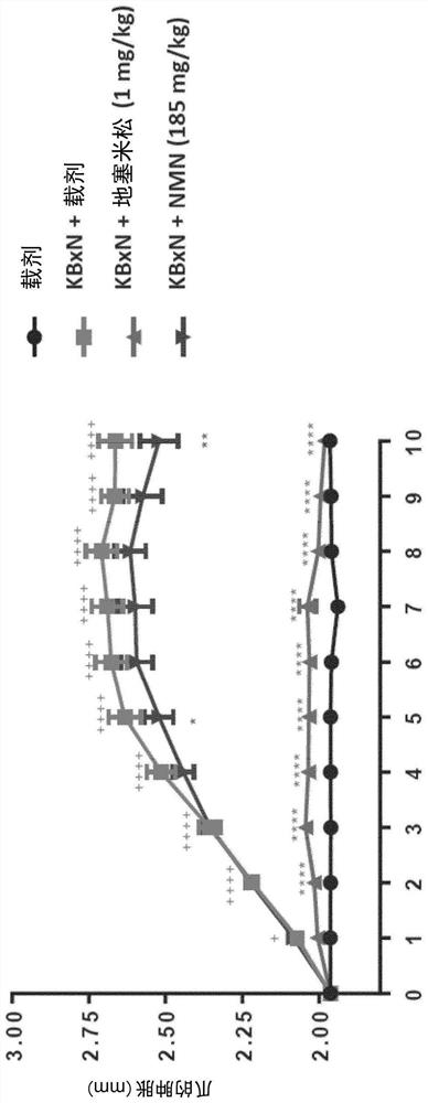 Use of nicotinamide mononucleotide (NMN) for prevention and/or treatment of rheumatoid arthritis and corresponding composition