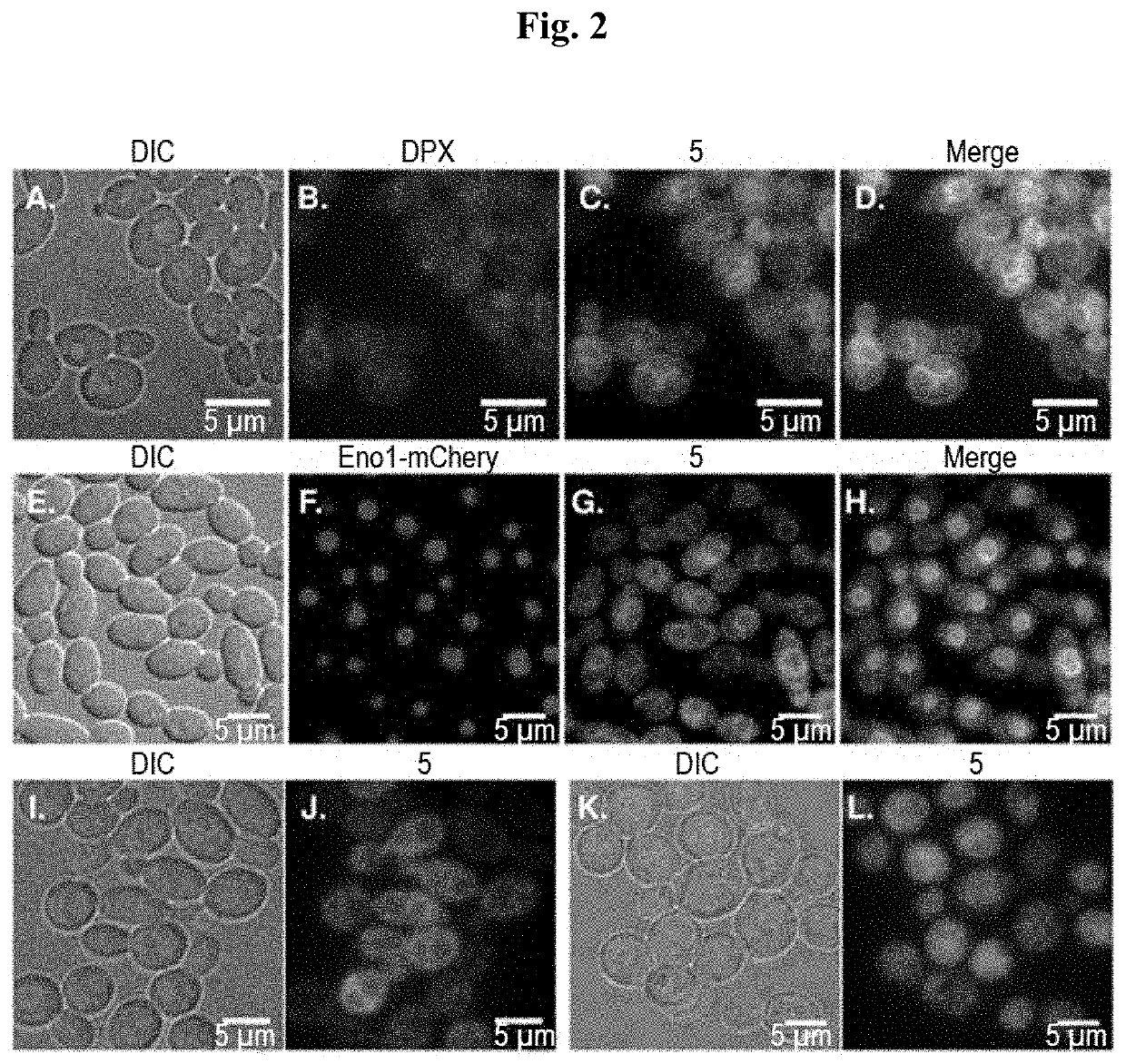 Fluorescent endoplasmic reticulum trackers for live cell imaging of pathogenic yeast