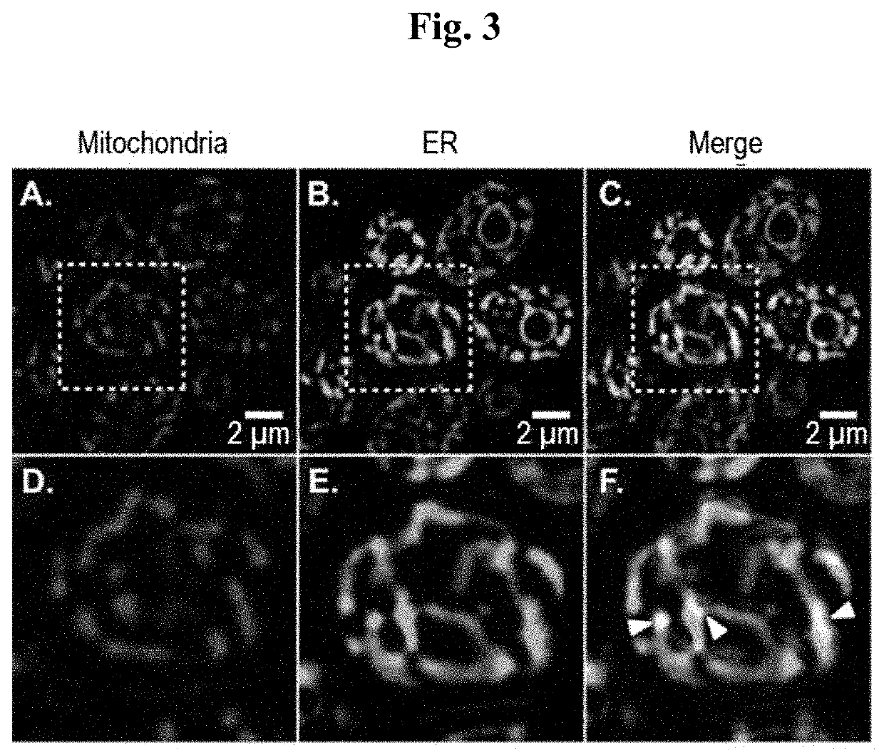 Fluorescent endoplasmic reticulum trackers for live cell imaging of pathogenic yeast