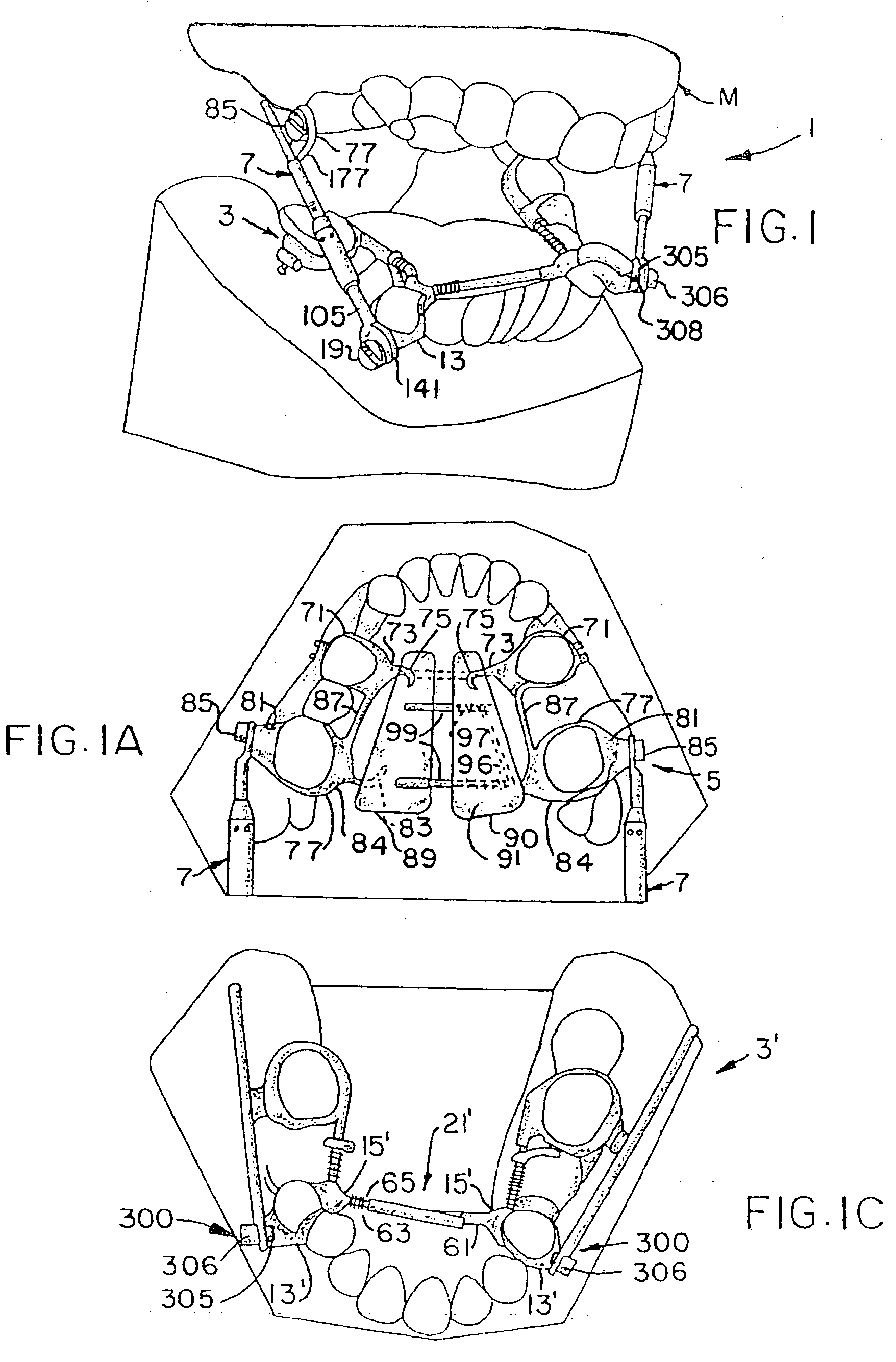 Slide on connector for arch wire