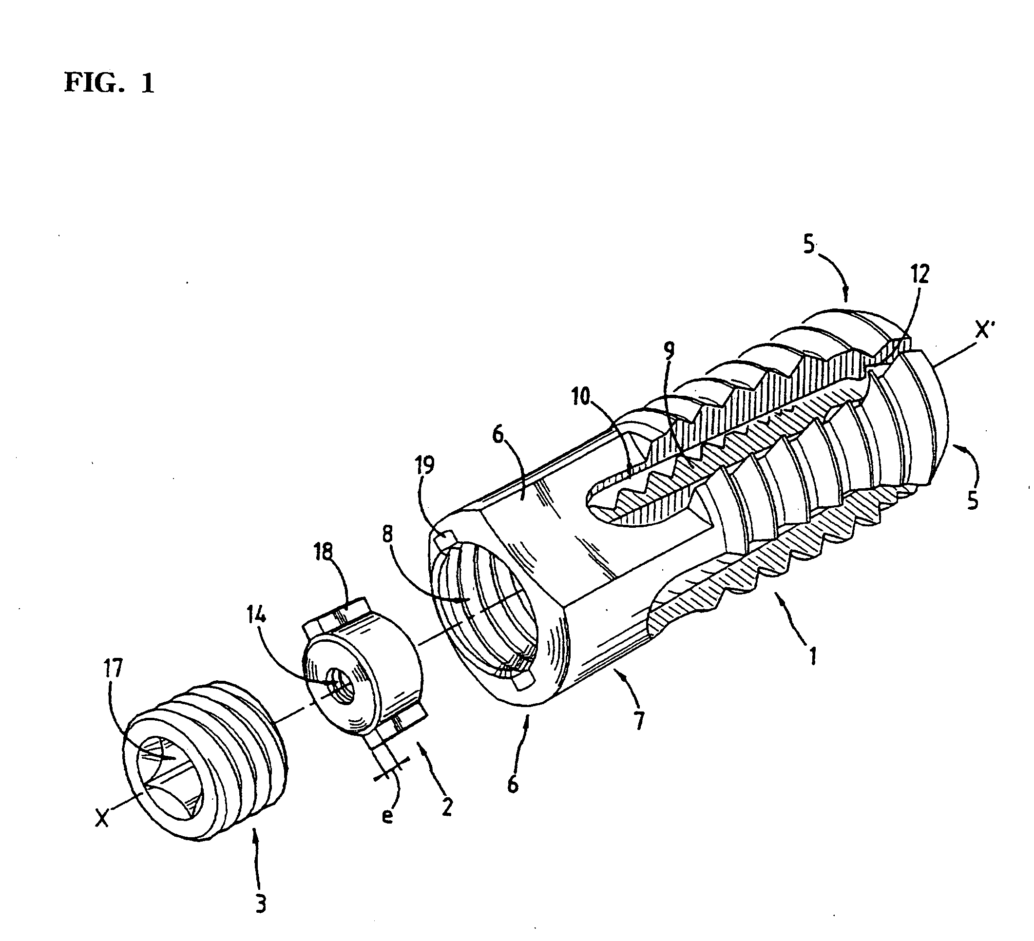 Expandable interfusion cage