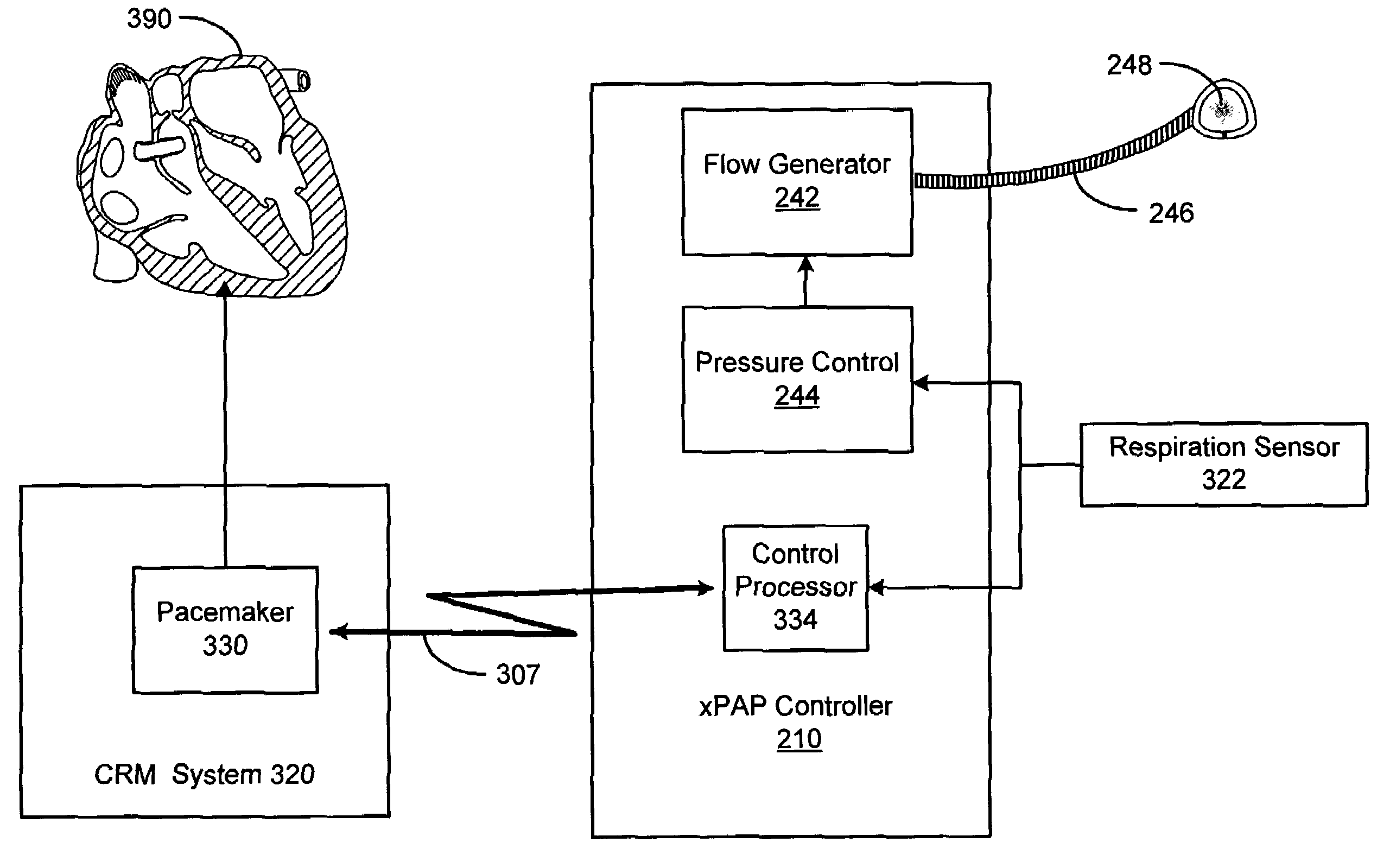 Method and apparatus for mimicking respiratory sinus arrhythmia with cardiac pacing controlled via external respiration therapy device