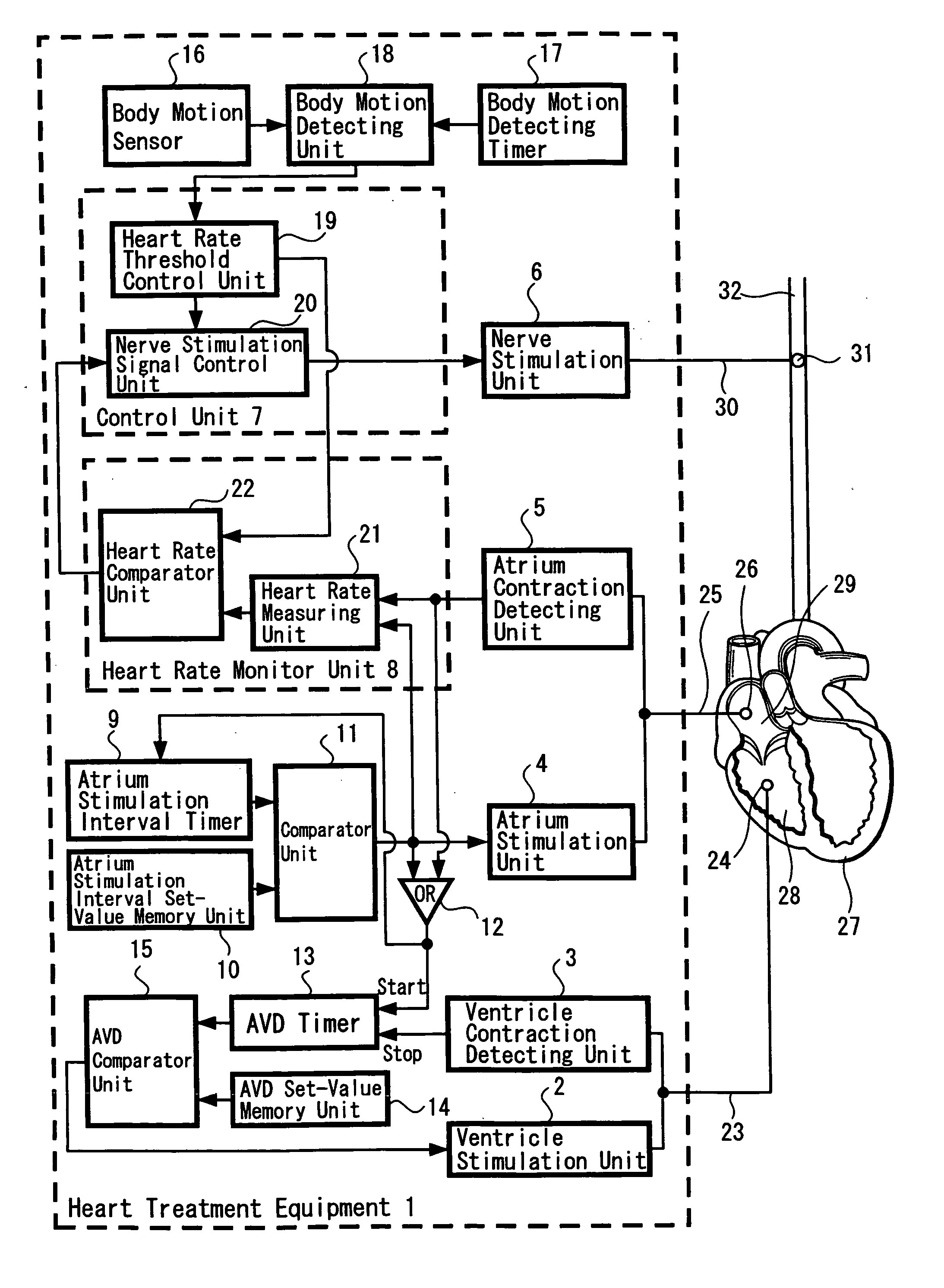 Heart treatment equipment and heart treatment method