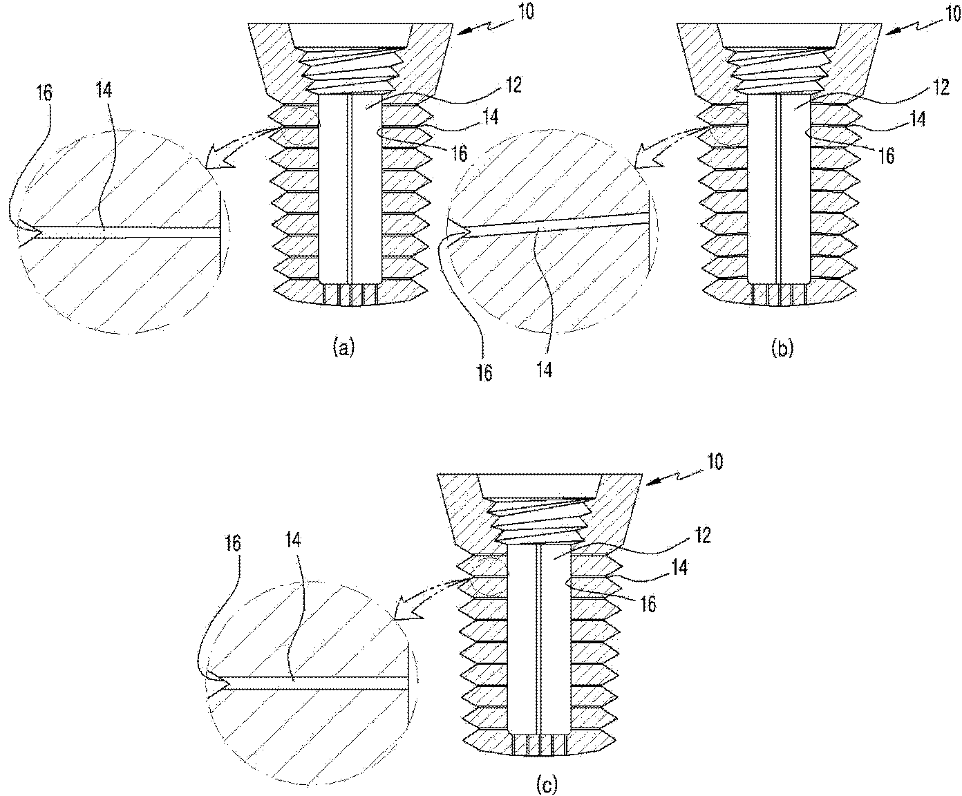 Drug delivery system using implant