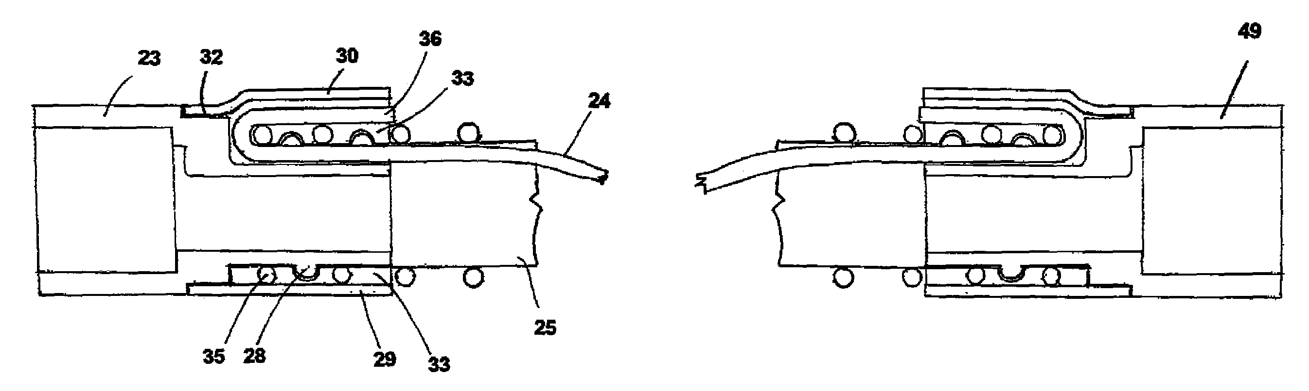 Limb for breathing circuit