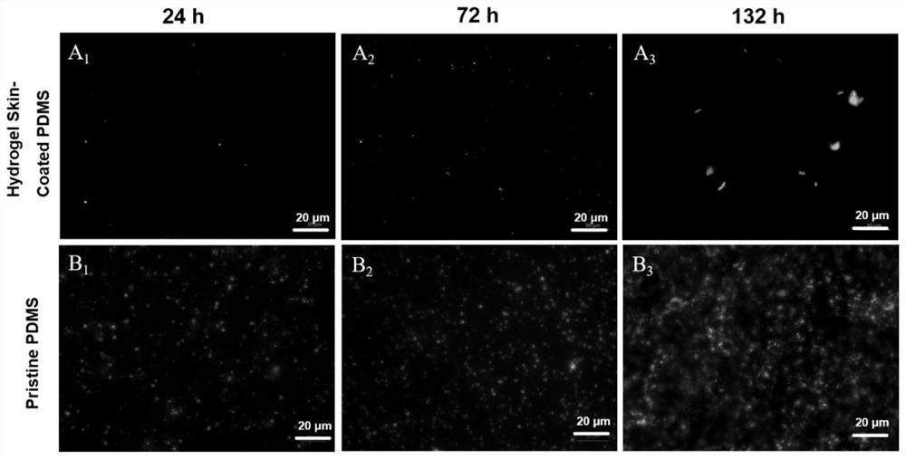 Antifouling zwitterionic hydrogel coating with bacterial responsiveness and preparation method of zwitterionic hydrogel coating