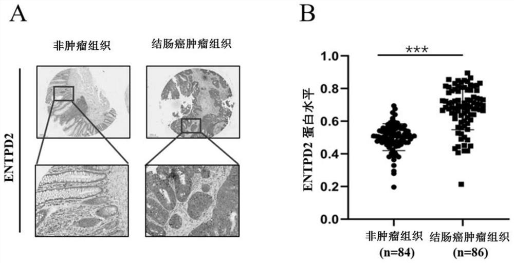 Colon cancer biomarker and application thereof