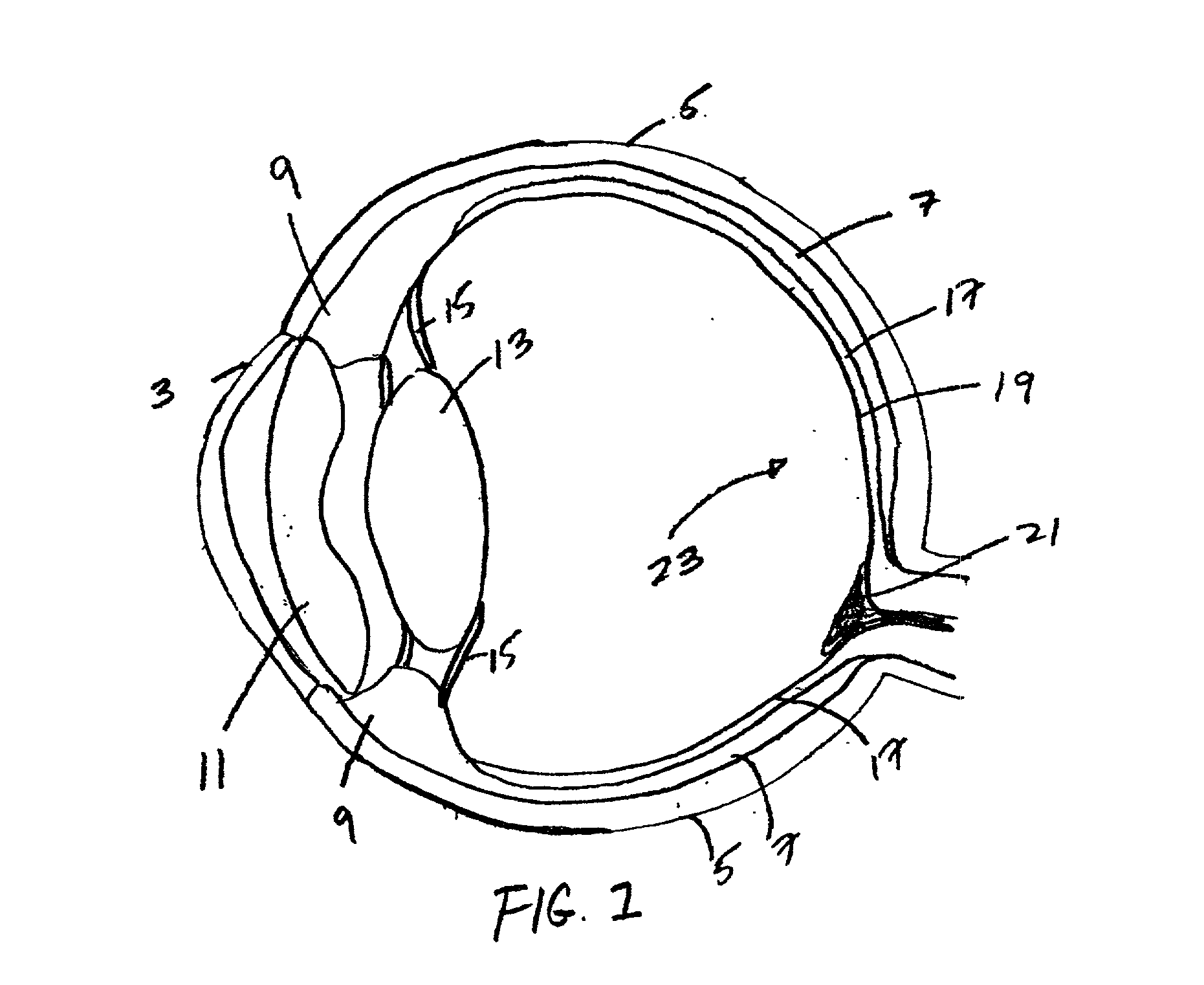 Modular adaptive optical subsystem for integration with a fundus camera body and CCD camera unit and improved fundus camera employing same