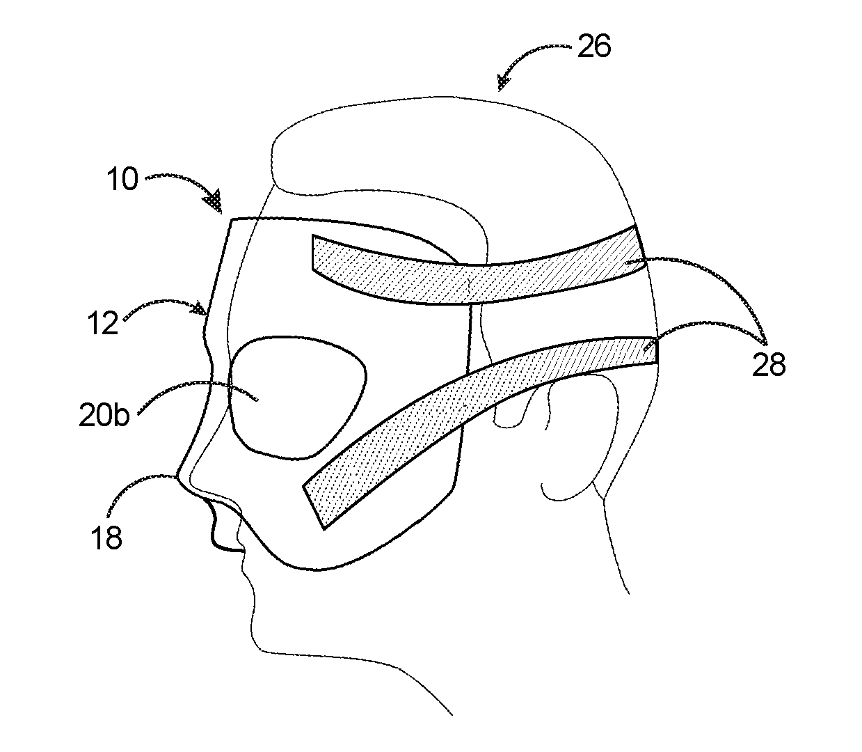 Face shield