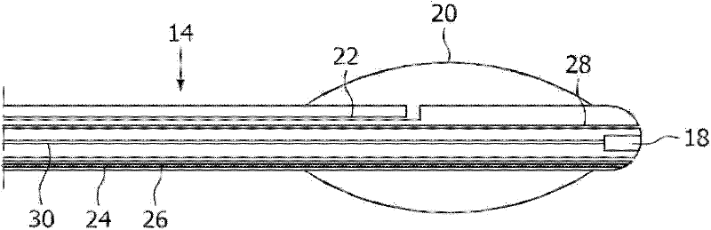 Active device tracking using light with orbital angular momentum to induce a hyperpolarized mri