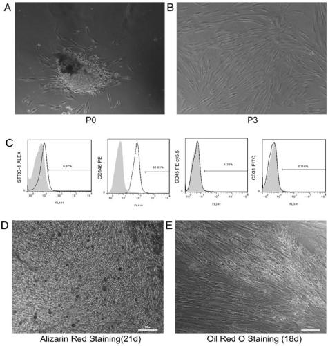 Application of lncrna-tug1 in the preparation of drugs regulating the stemness maintenance ability of periodontal ligament stem cells