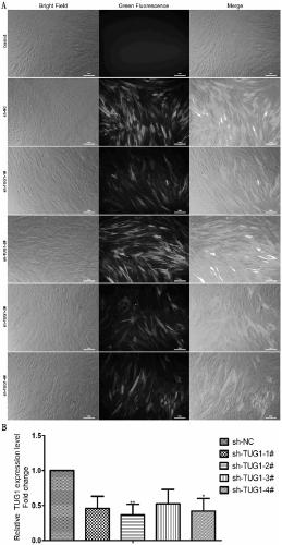 Application of lncrna-tug1 in the preparation of drugs regulating the stemness maintenance ability of periodontal ligament stem cells