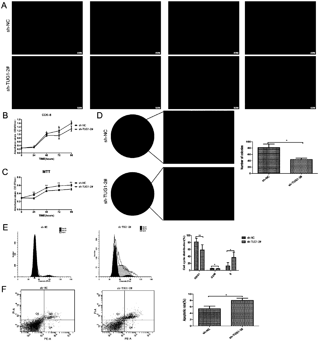 Application of lncrna-tug1 in the preparation of drugs regulating the stemness maintenance ability of periodontal ligament stem cells