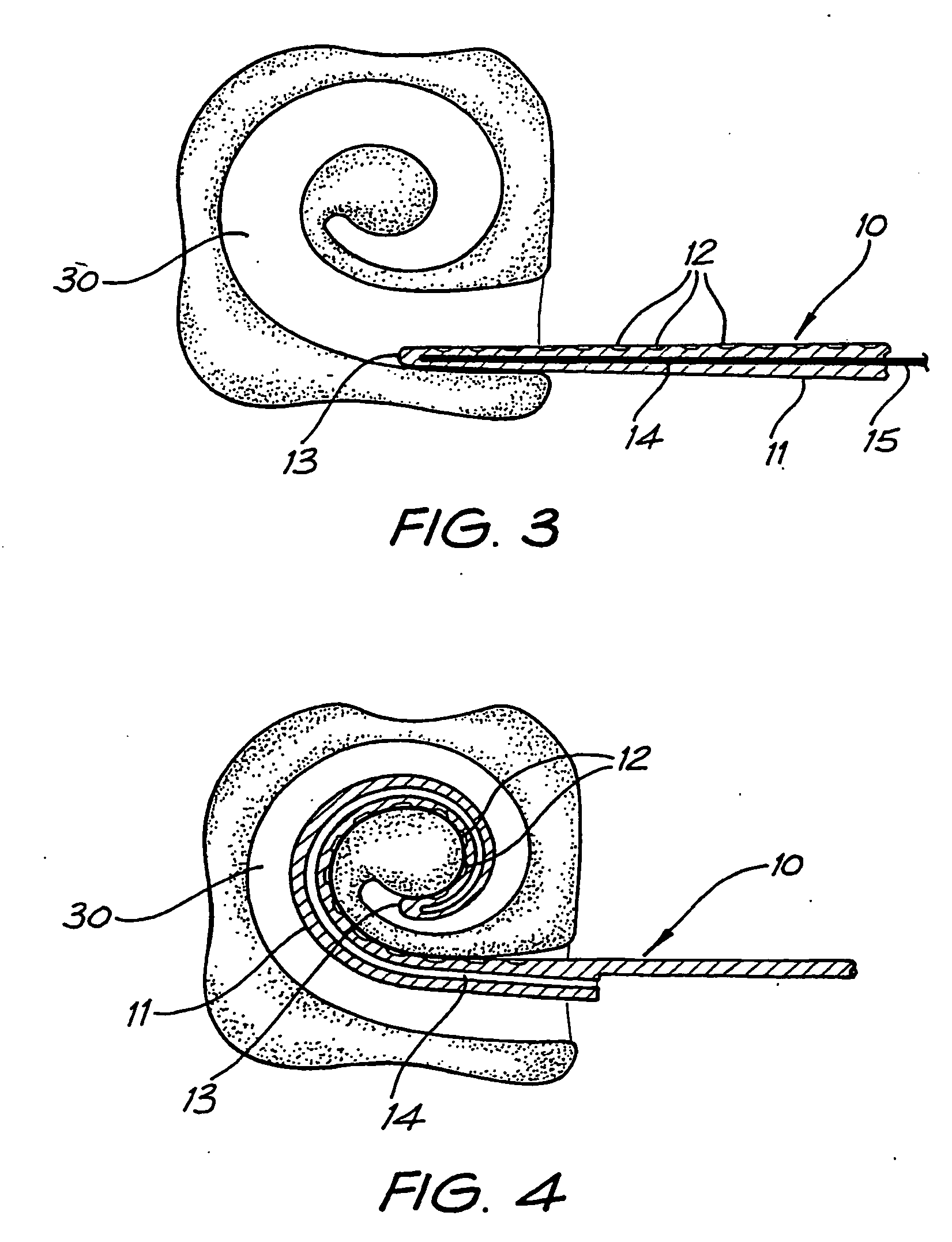 Cochlear implant electrode array