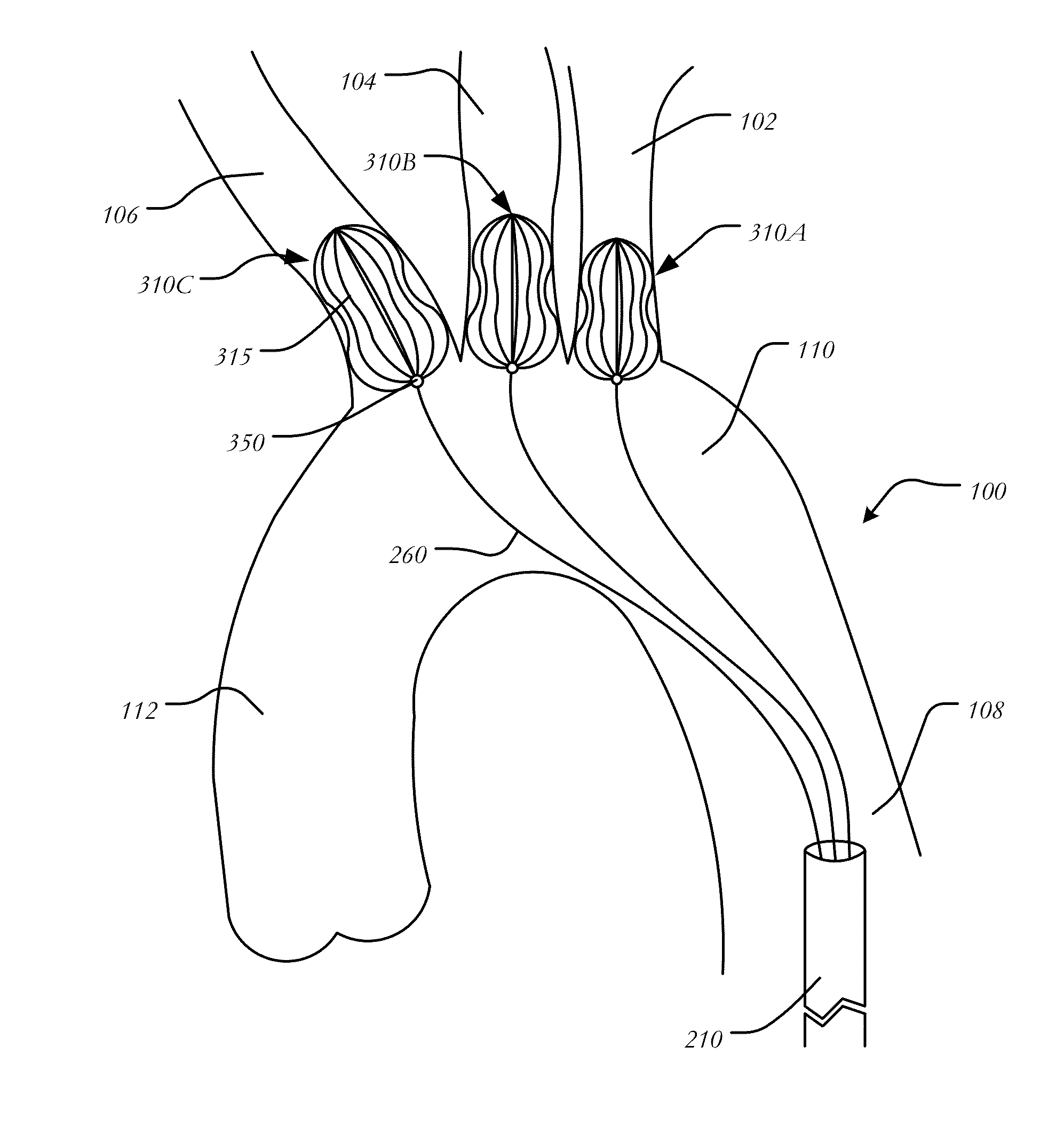 Aortic great vessel protection