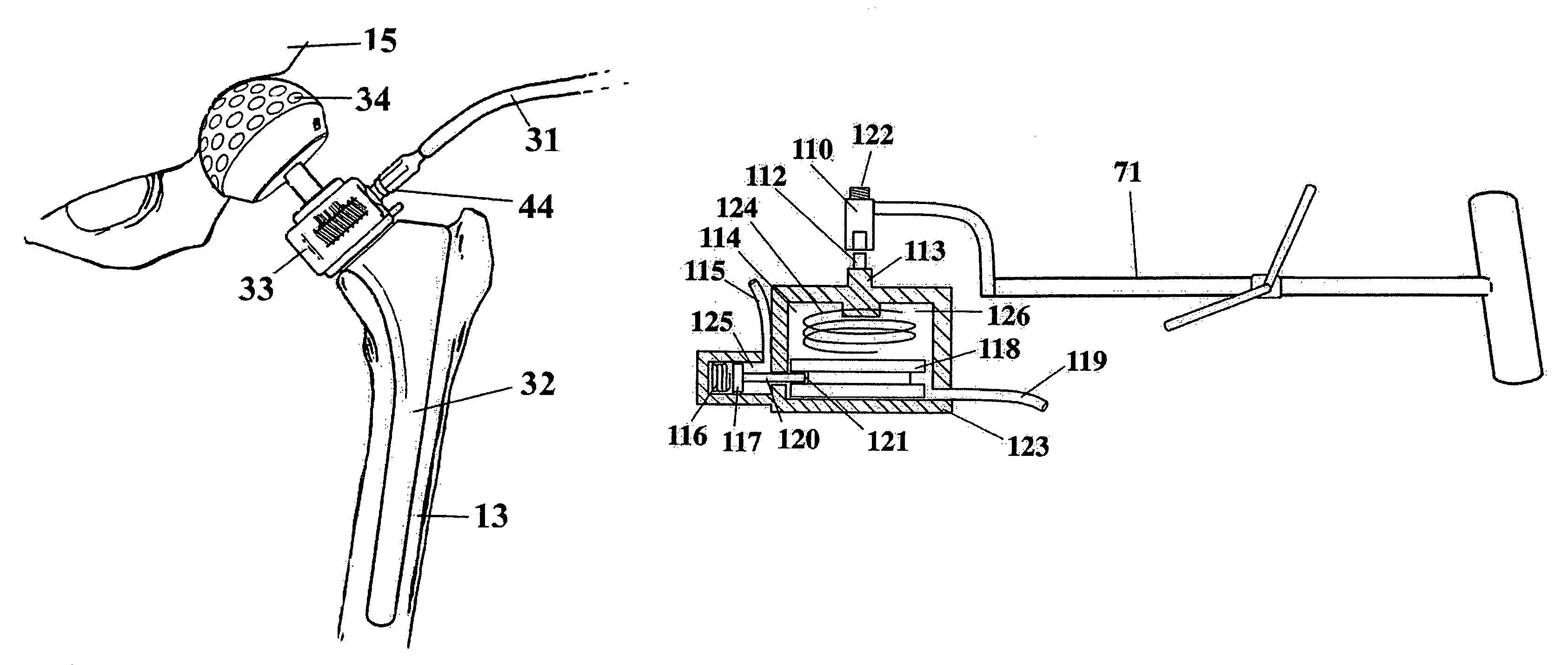 Apparatus and method for minimally invasive total joint replacement