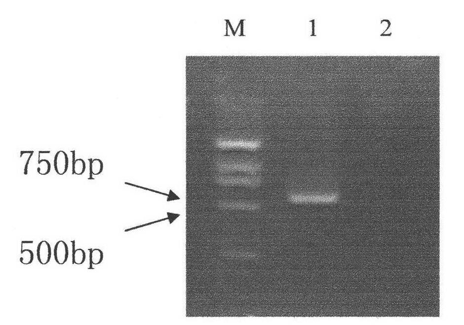 Development and applications of new human gene FAMLF in human gene recombination, malignant tumor gene detection and specific monoclonal antibody