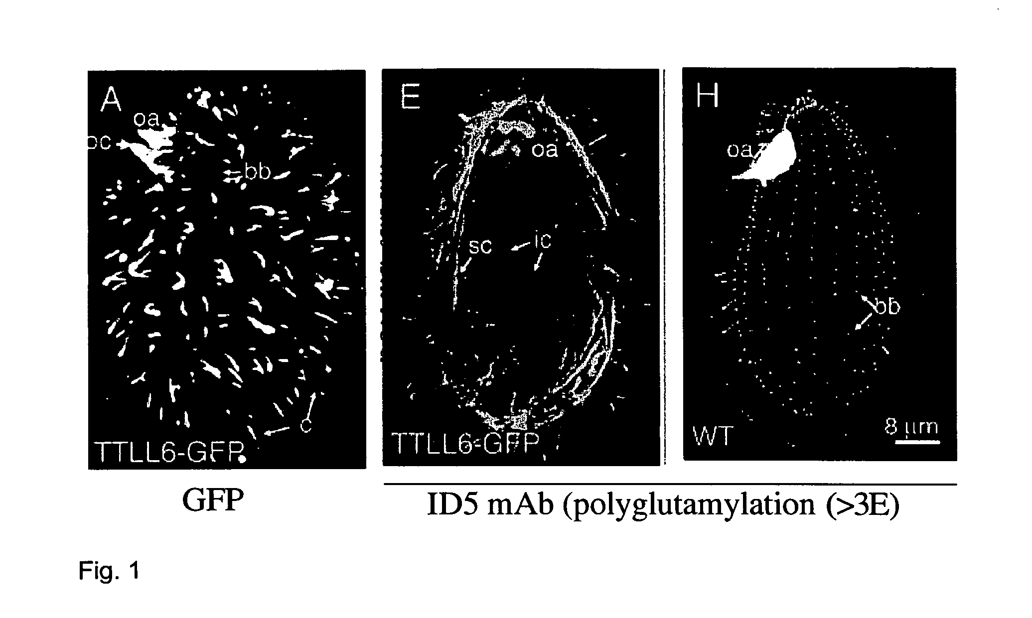 Biological system and assay for identifying inhibitors of tubulin glutamylases